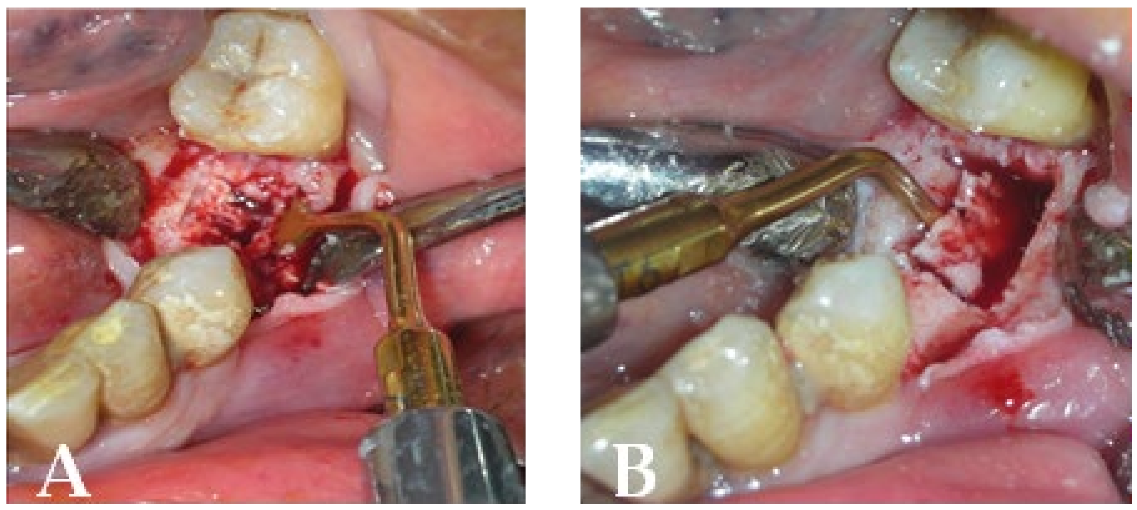 Bioengineering 10 00863 g017