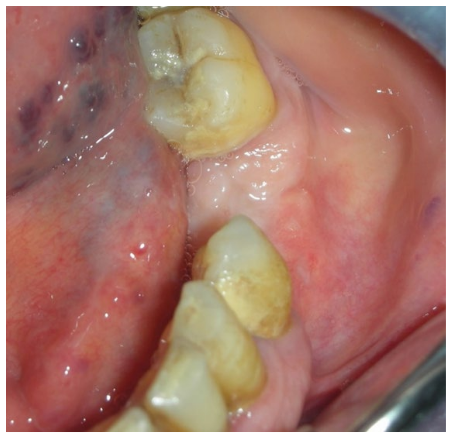 Bioengineering 10 00863 g019