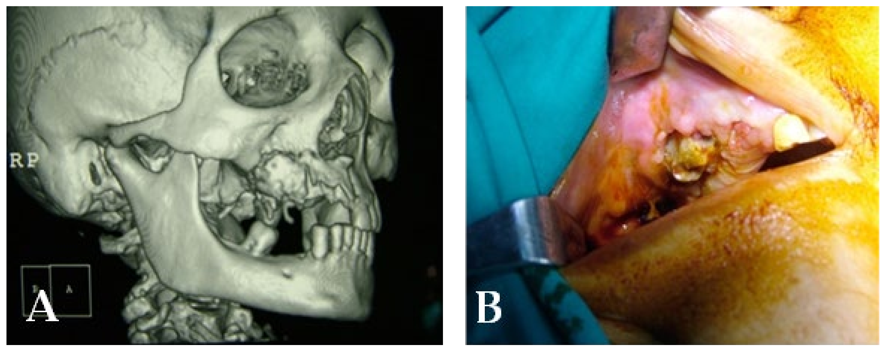 Bioengineering 10 00863 g020