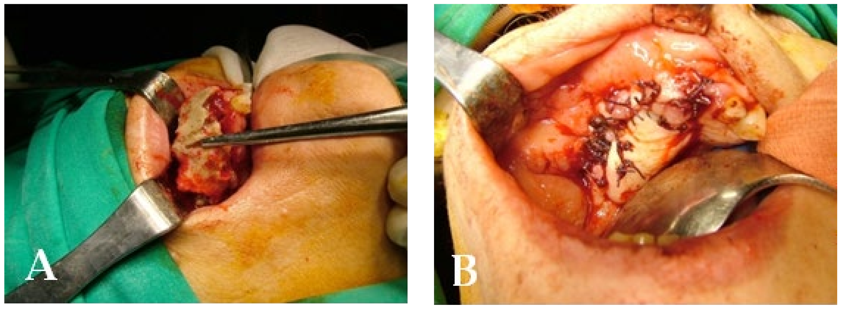 Bioengineering 10 00863 g021