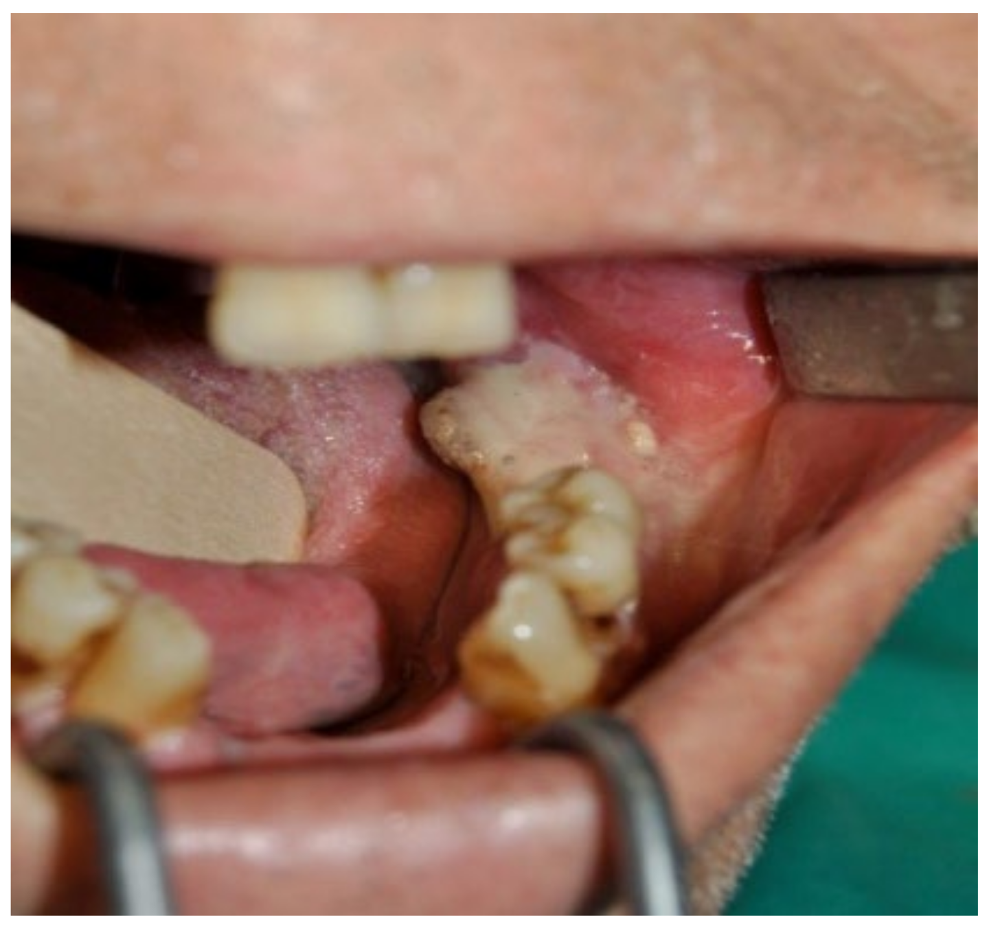 Bioengineering 10 00863 g023