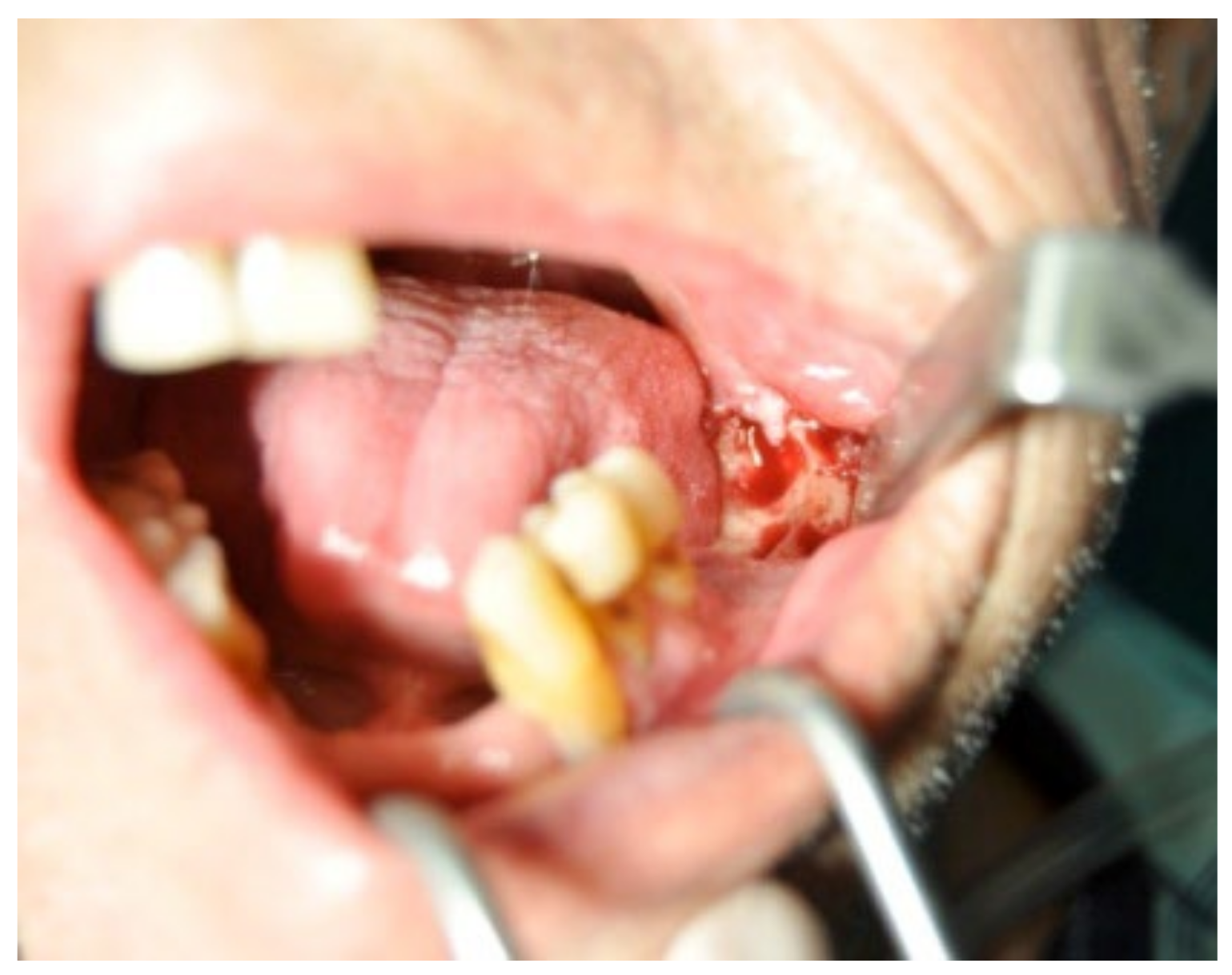 Bioengineering 10 00863 g024