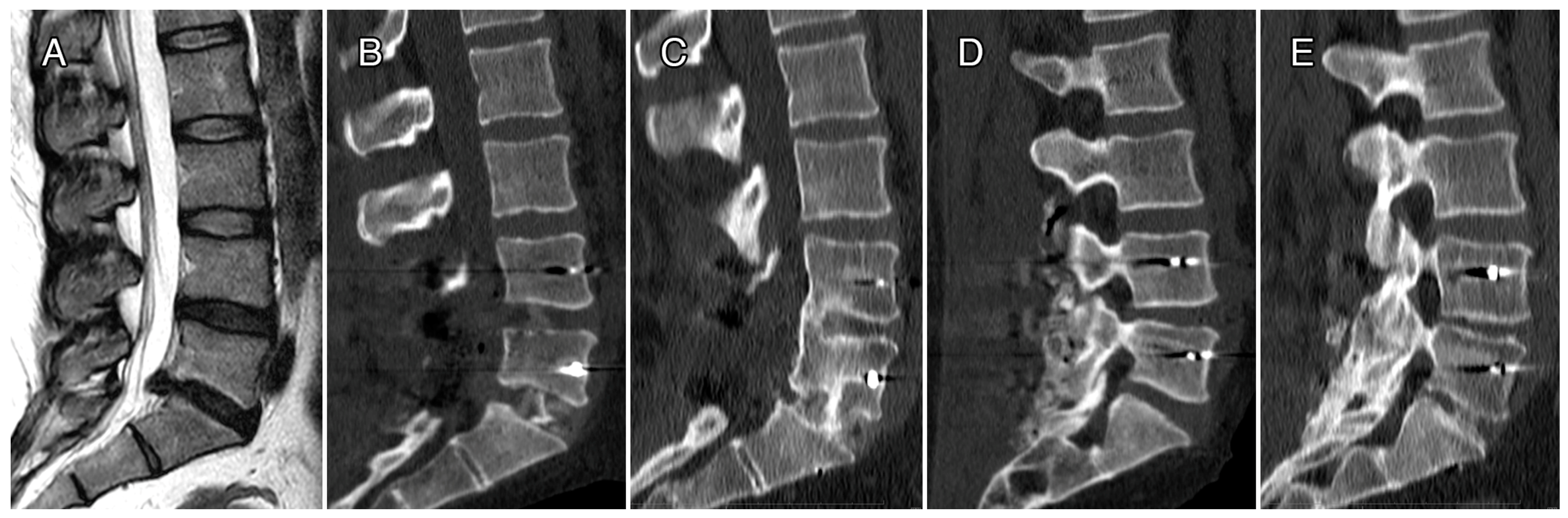 Bioengineering 10 00872 g004