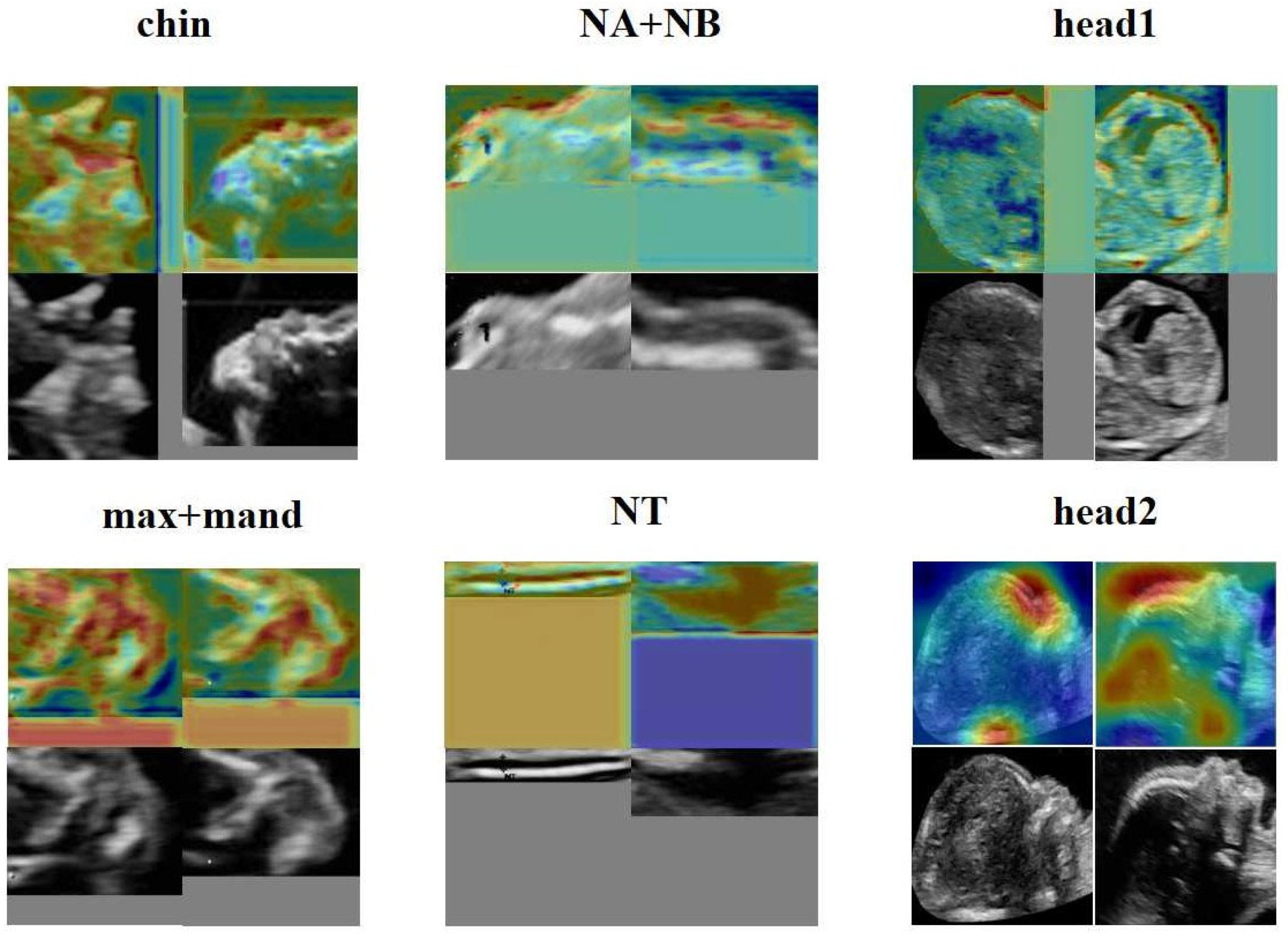 Bioengineering 10 00873 g008