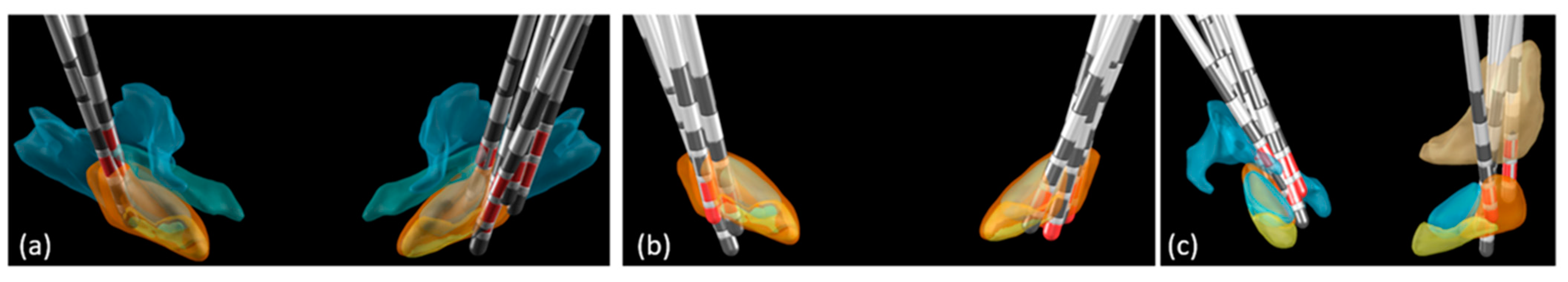 Bioengineering 10 00898 g006