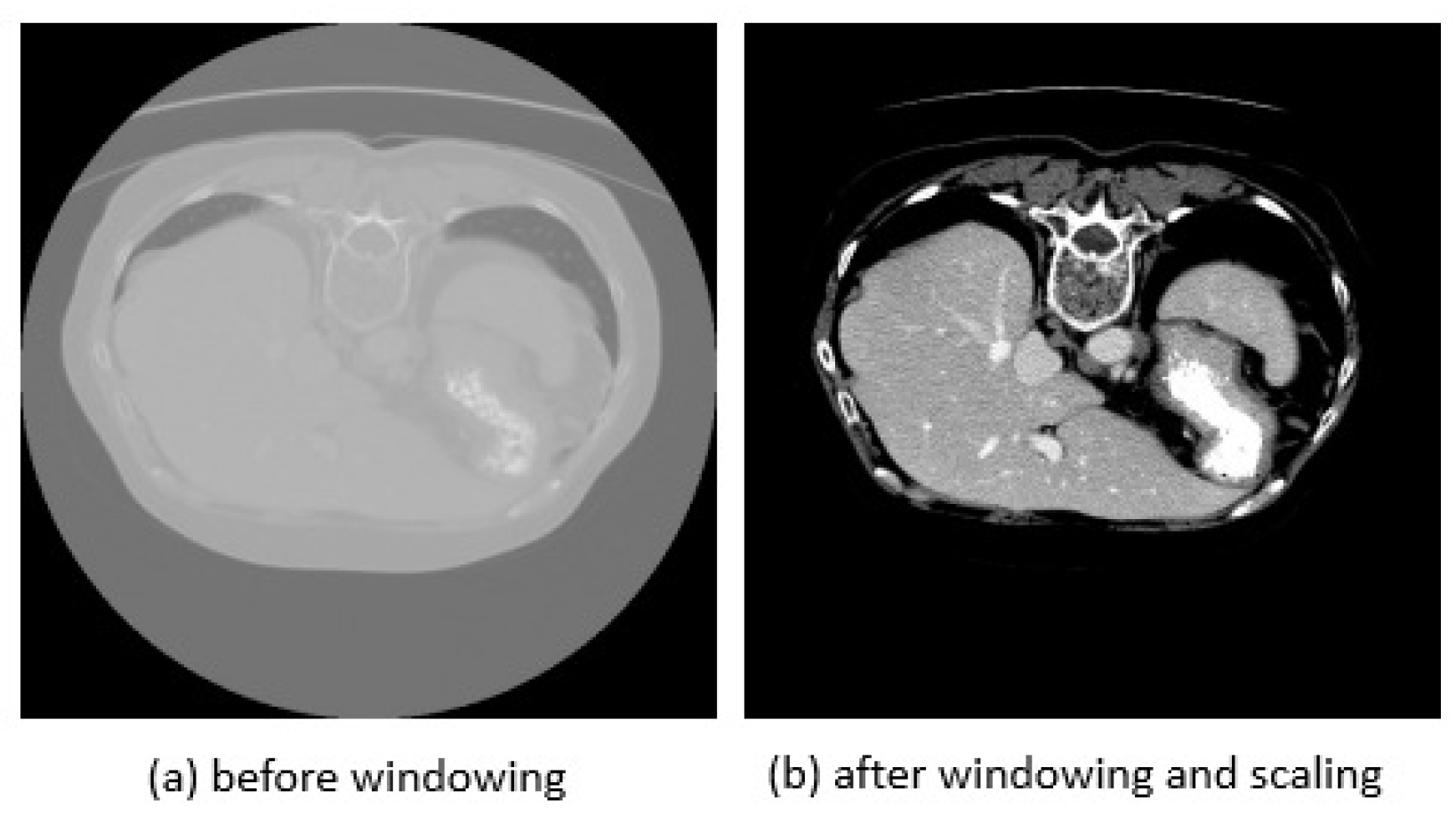 Bioengineering 10 00899 g003