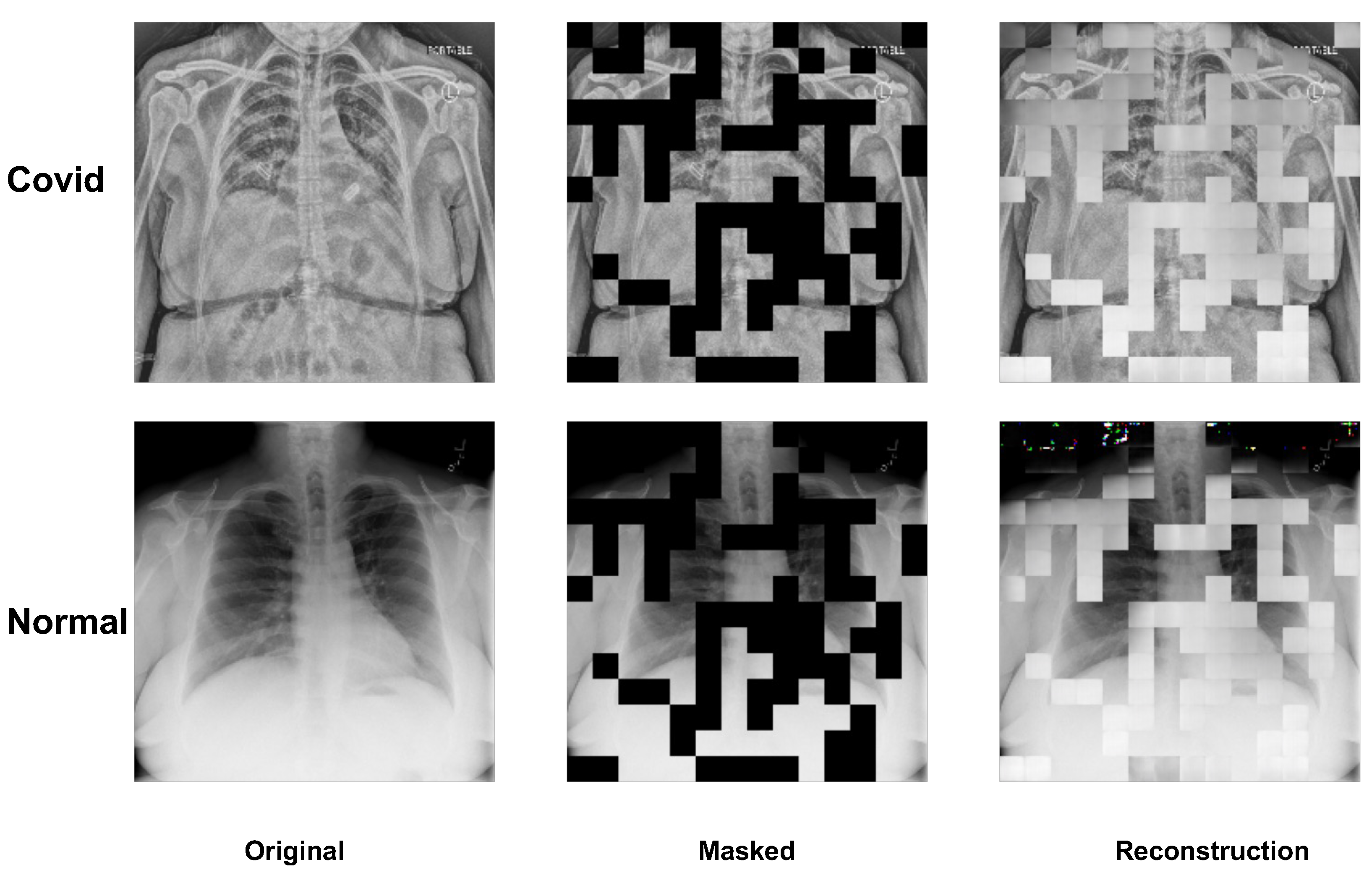 Self-Supervised Learning Application on COVID-19 Chest X-ray Image ...
