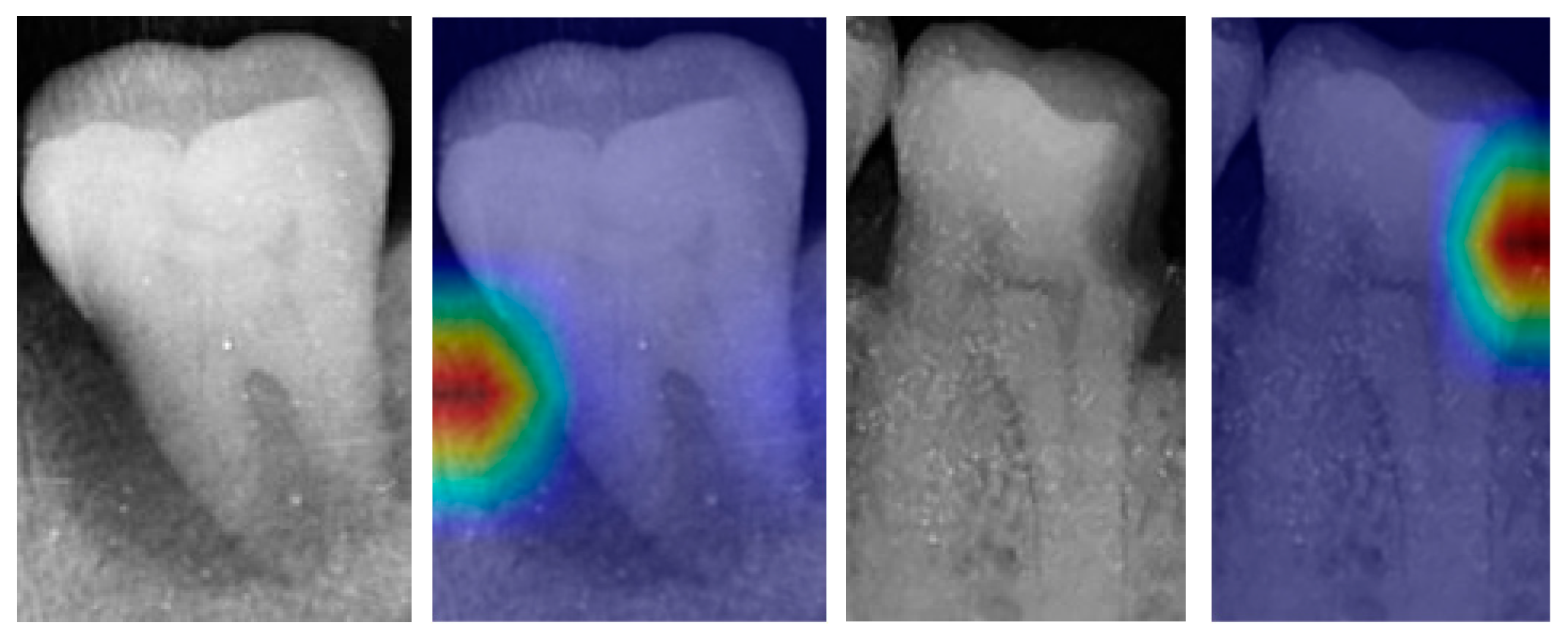 Bioengineering 10 00911 g009