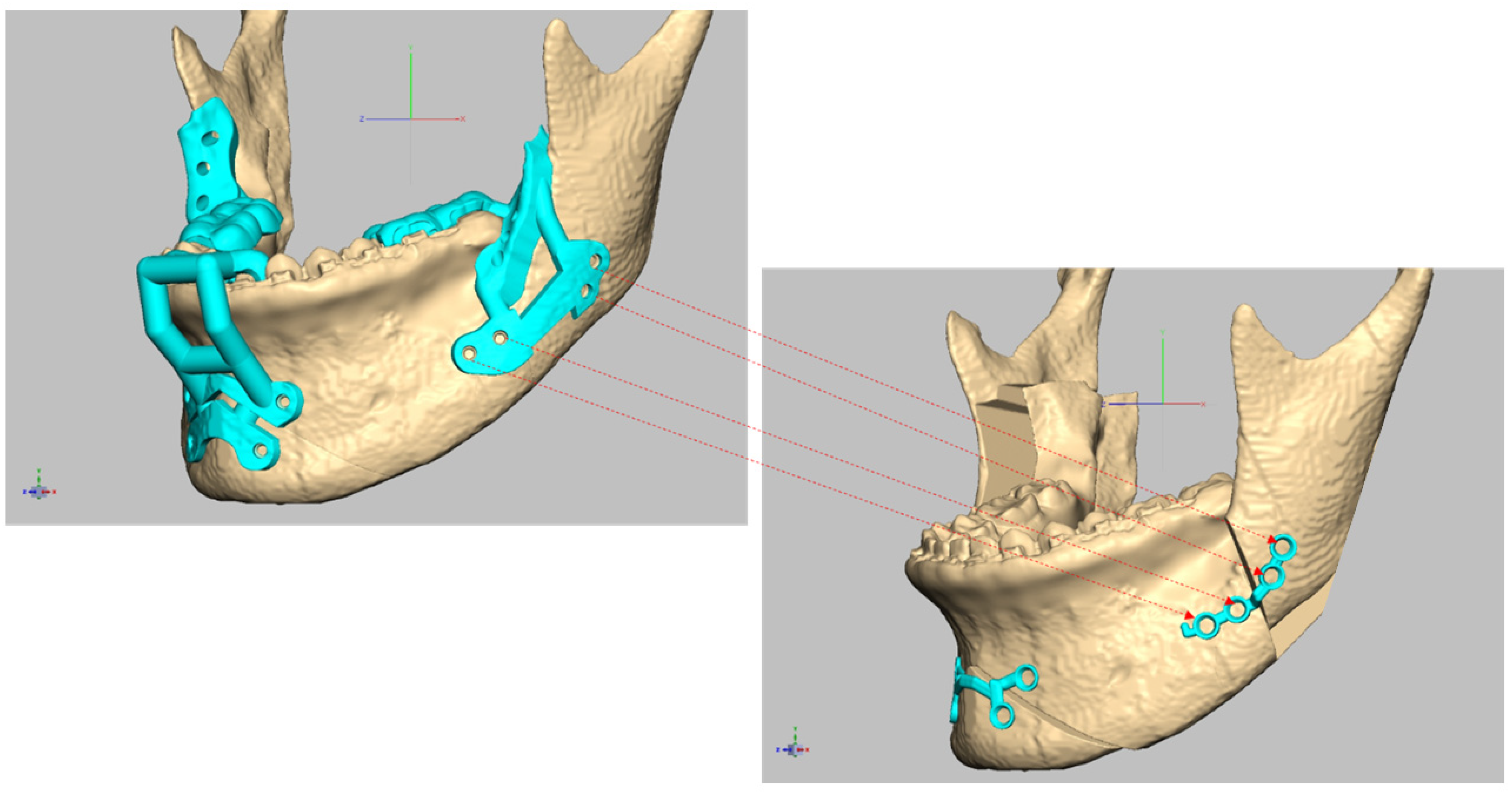 Bioengineering 10 00914 g005