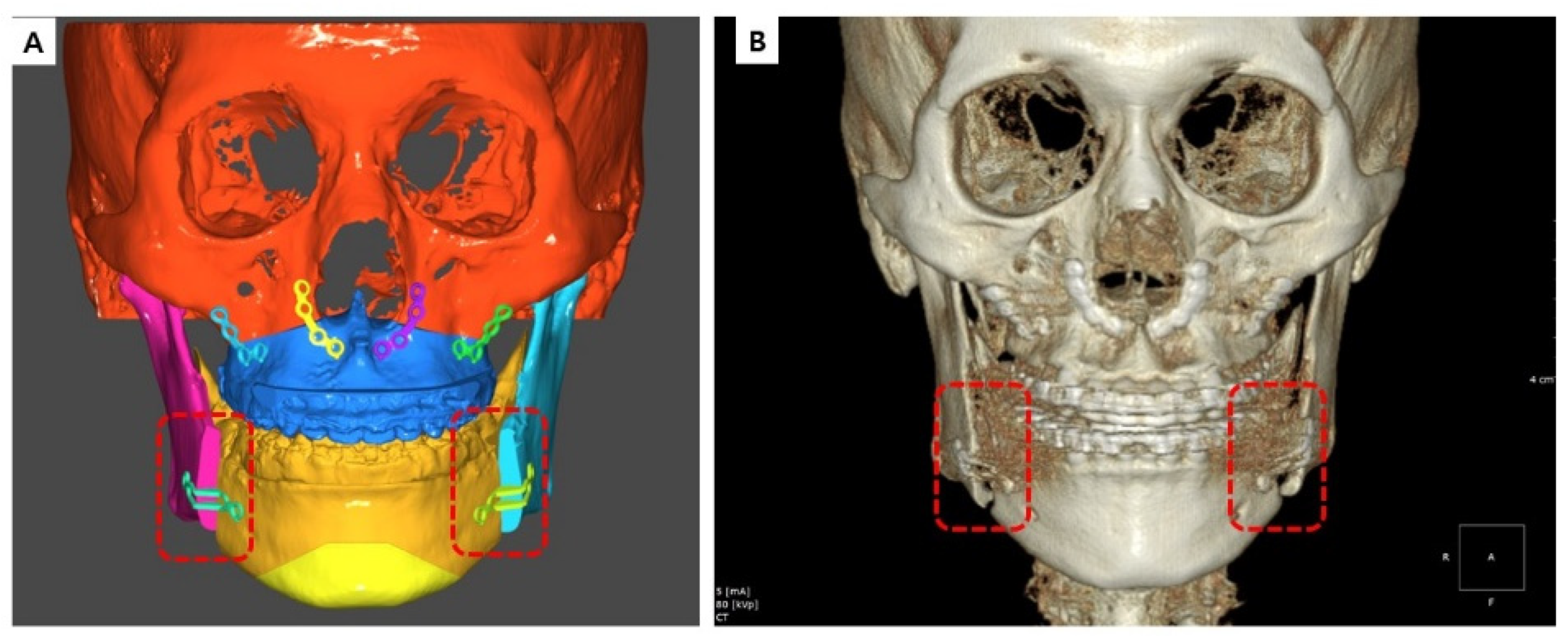 Bioengineering 10 00914 g010