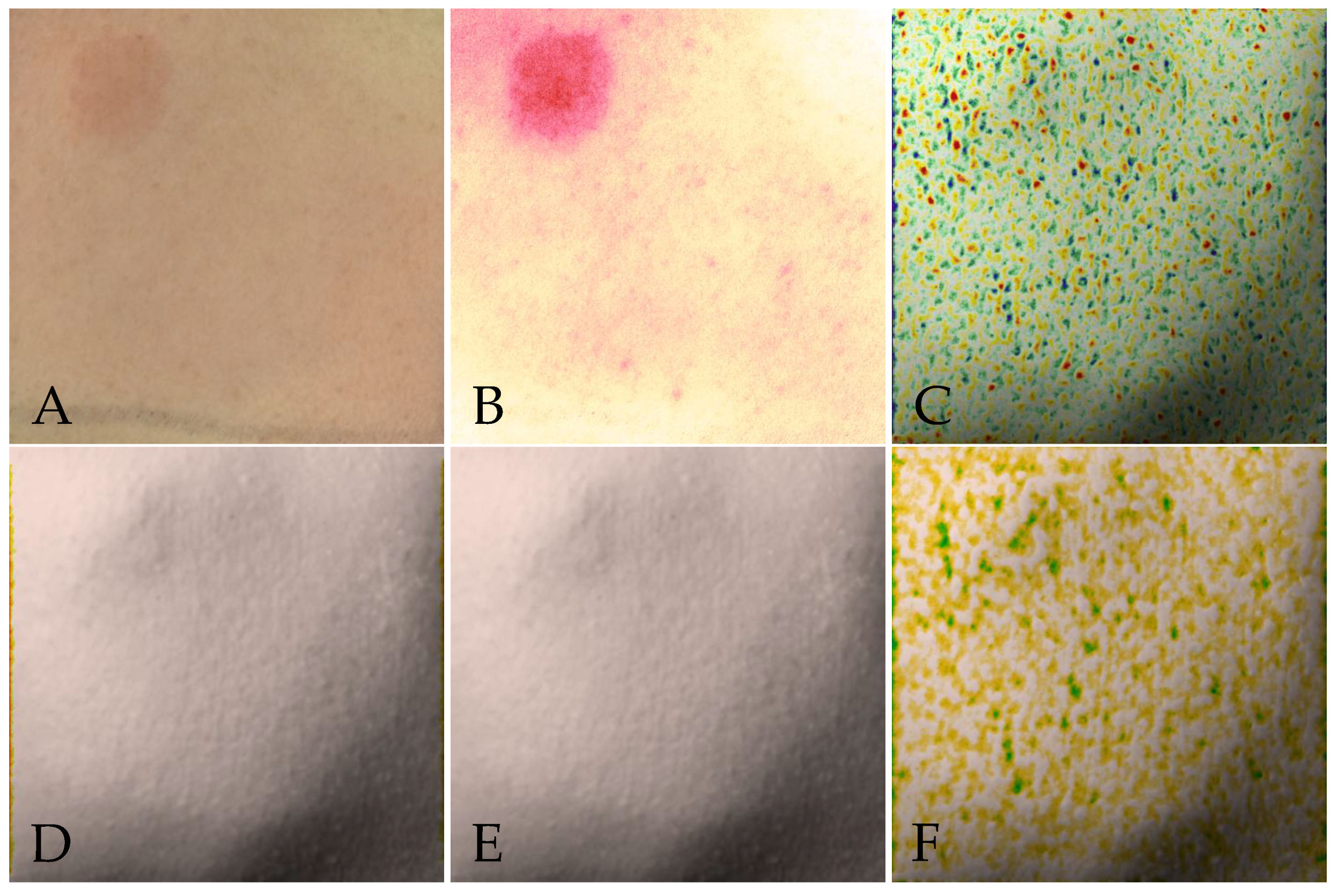 Bioengineering 10 00924 g002