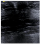 Bioengineering 10 00940 i001