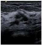 Bioengineering 10 00940 i003