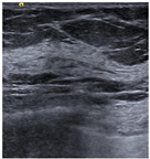 Bioengineering 10 00940 i004