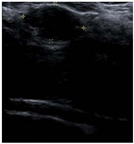 Bioengineering 10 00940 i005