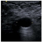 Bioengineering 10 00940 i006