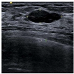 Bioengineering 10 00940 i008