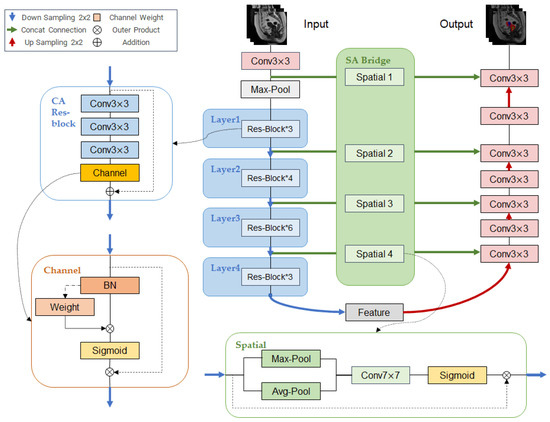WA-ResUNet: A Focused Tail Class MRI Medical Image Segmentation 