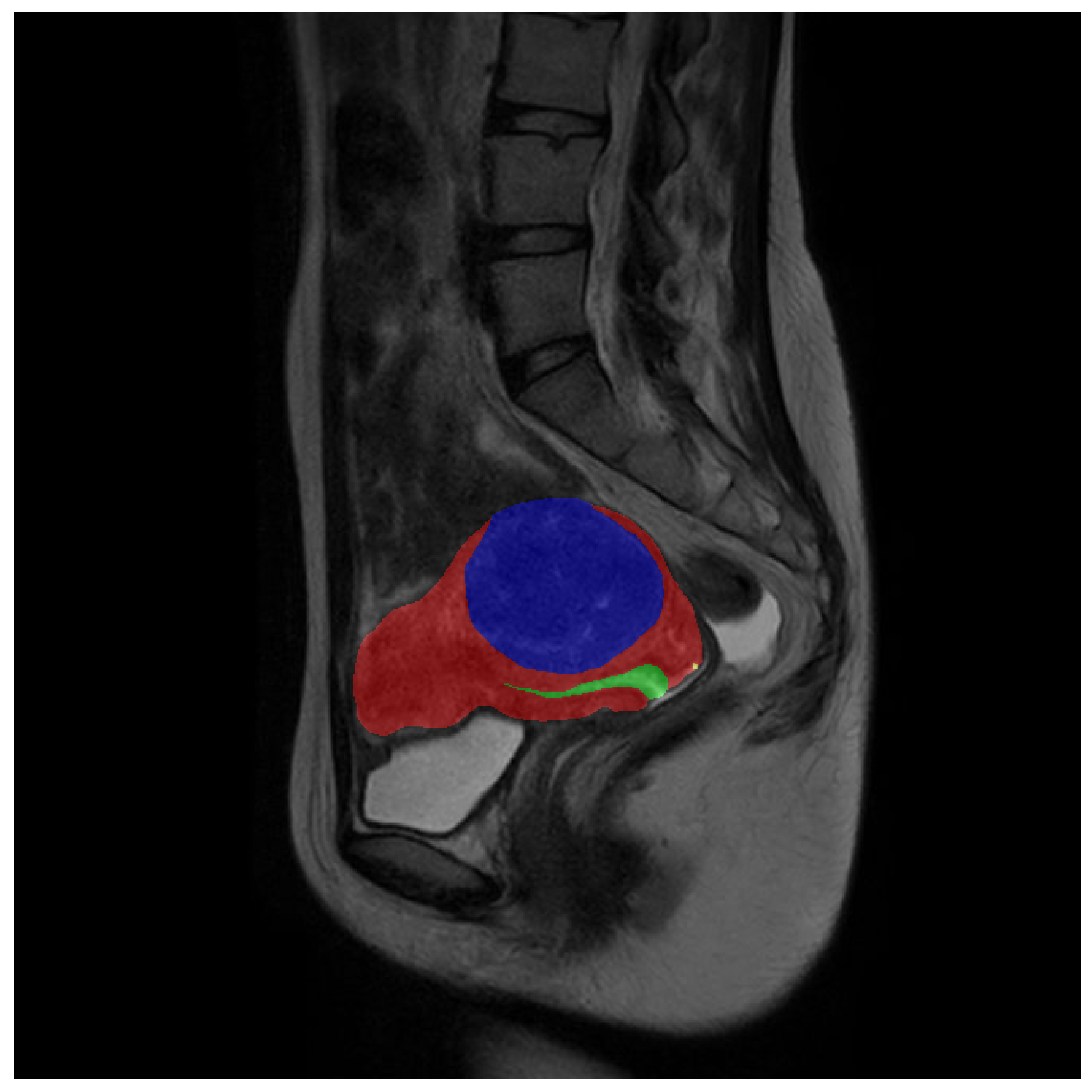 Bioengineering 10 00945 g004