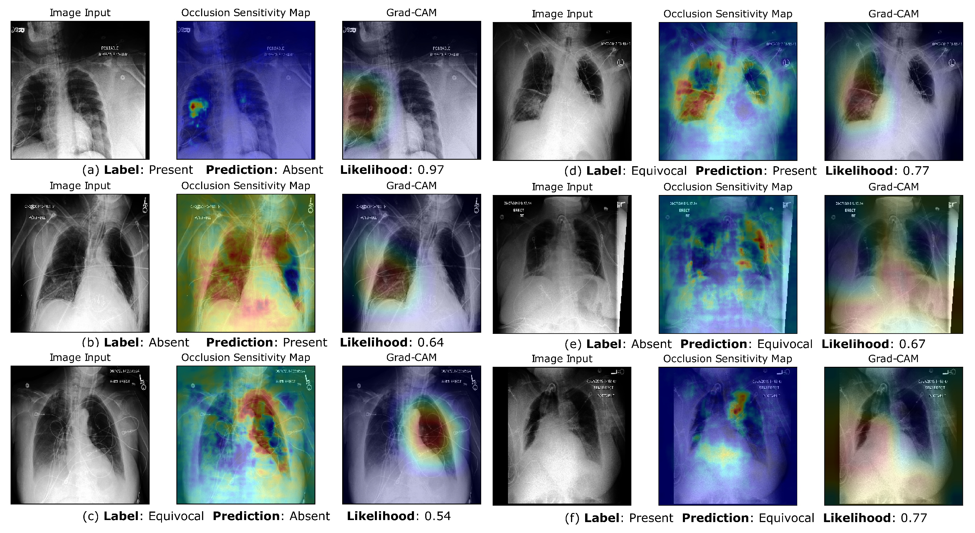 Bioengineering | Free Full-Text | Uncertainty-Aware Convolutional Neural  Network for Identifying Bilateral Opacities on Chest X-rays: A Tool to Aid  Diagnosis of Acute Respiratory Distress Syndrome