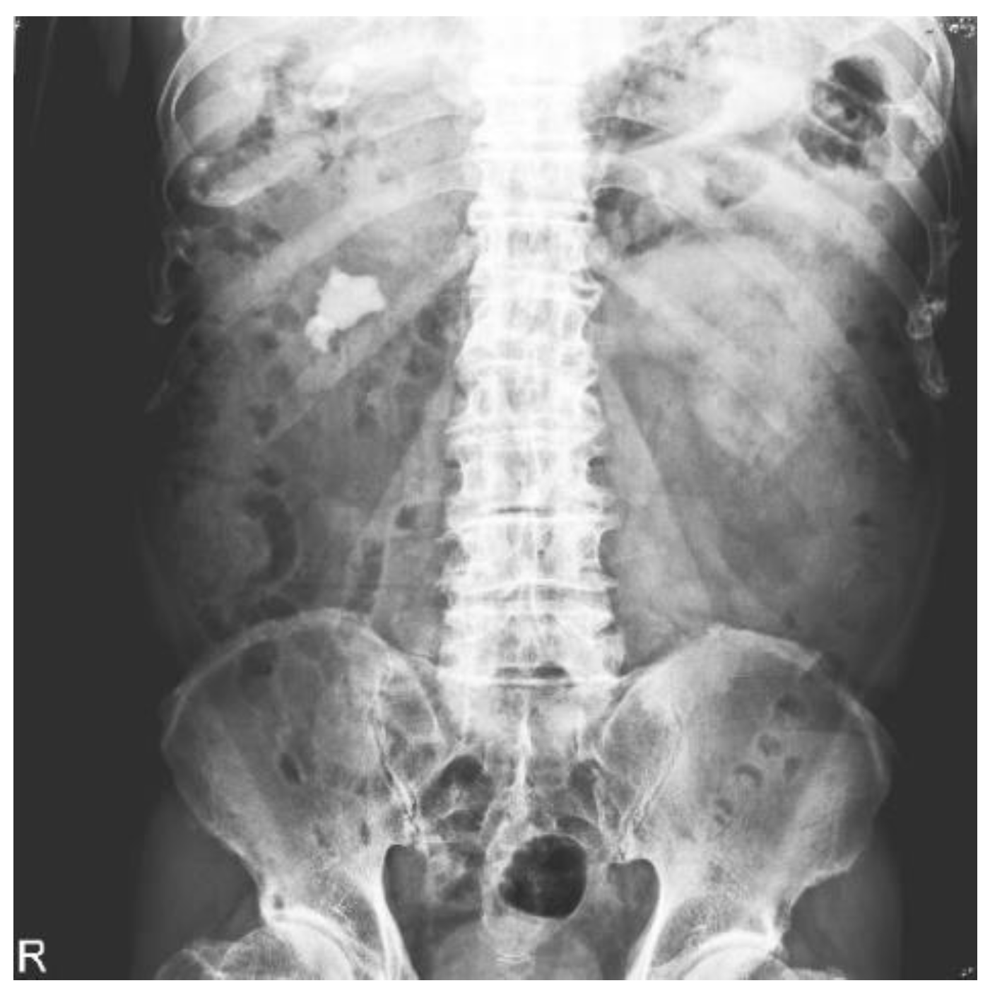 Bioengineering 10 00970 g003