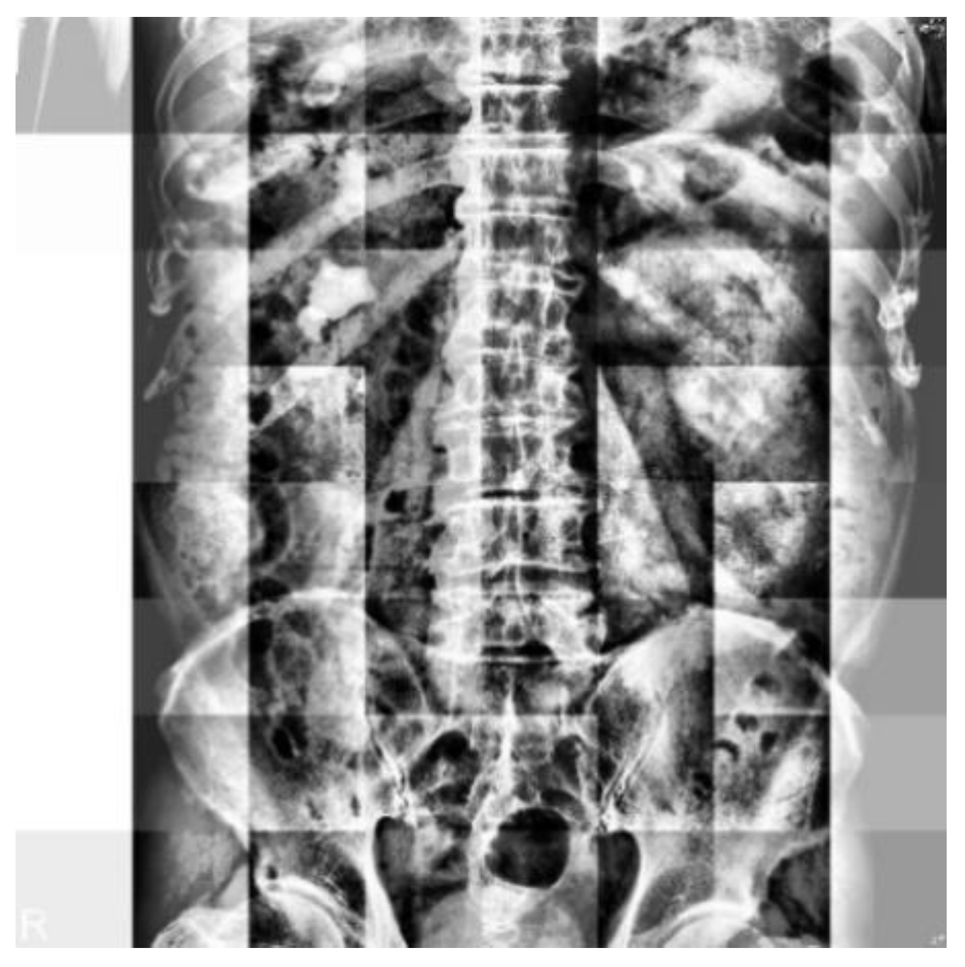 Bioengineering 10 00970 g004