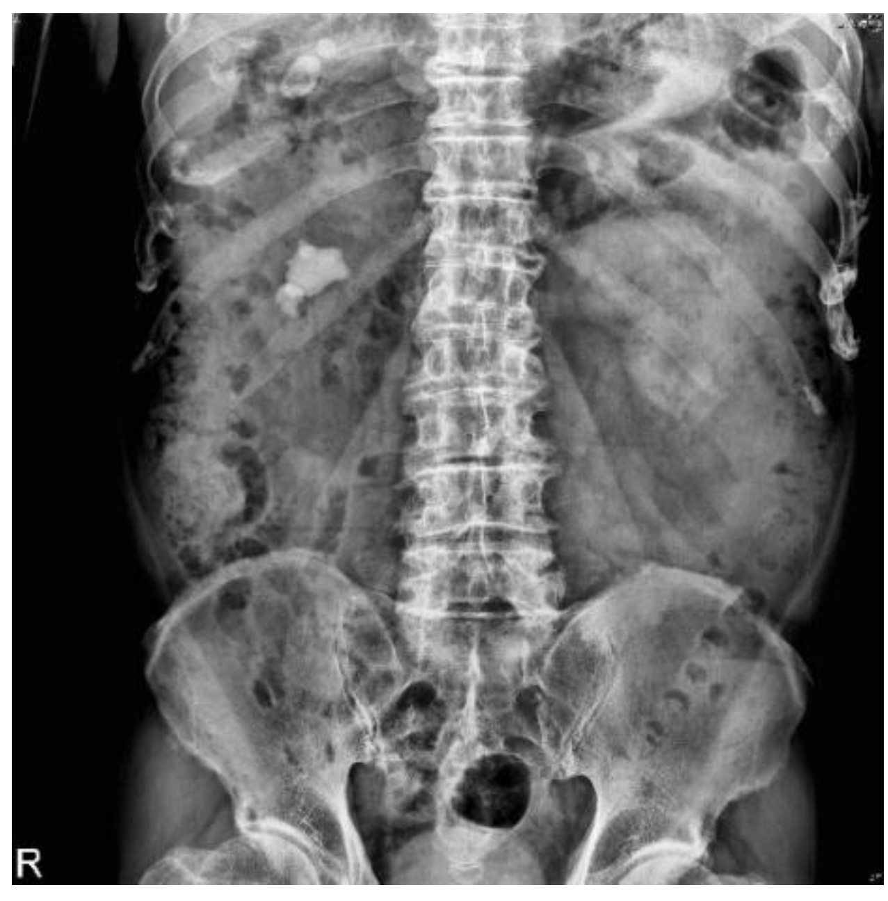 Bioengineering 10 00970 g006