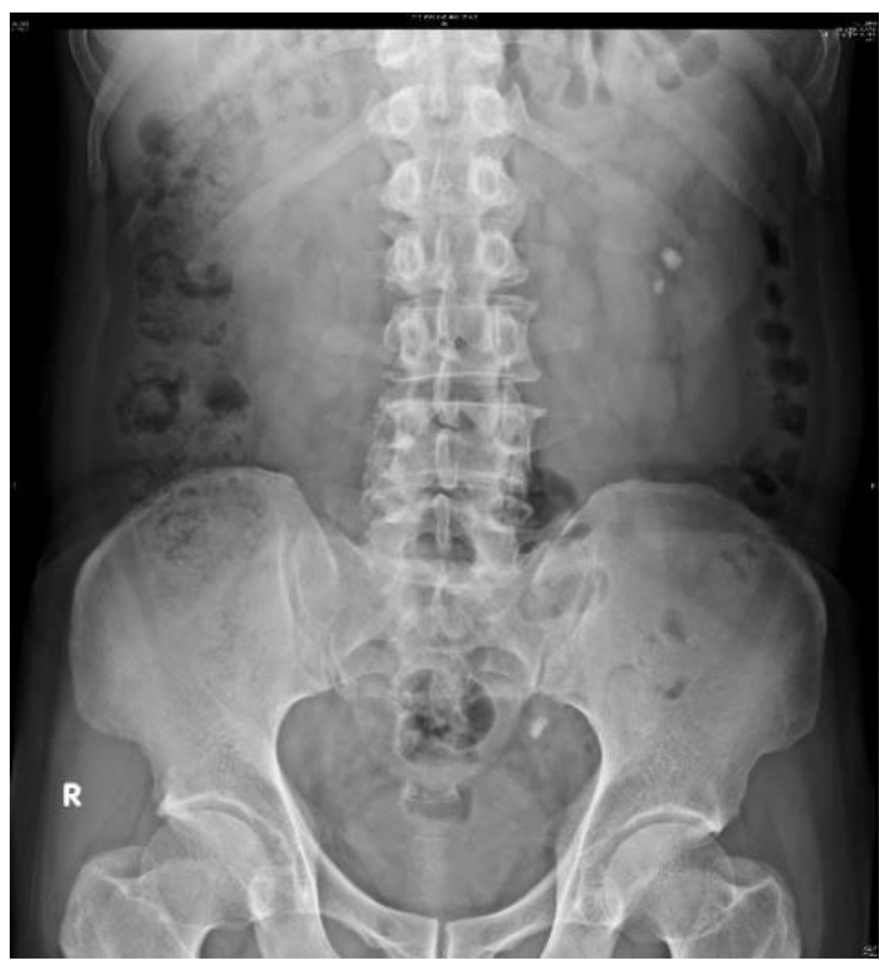 Bioengineering 10 00970 g007