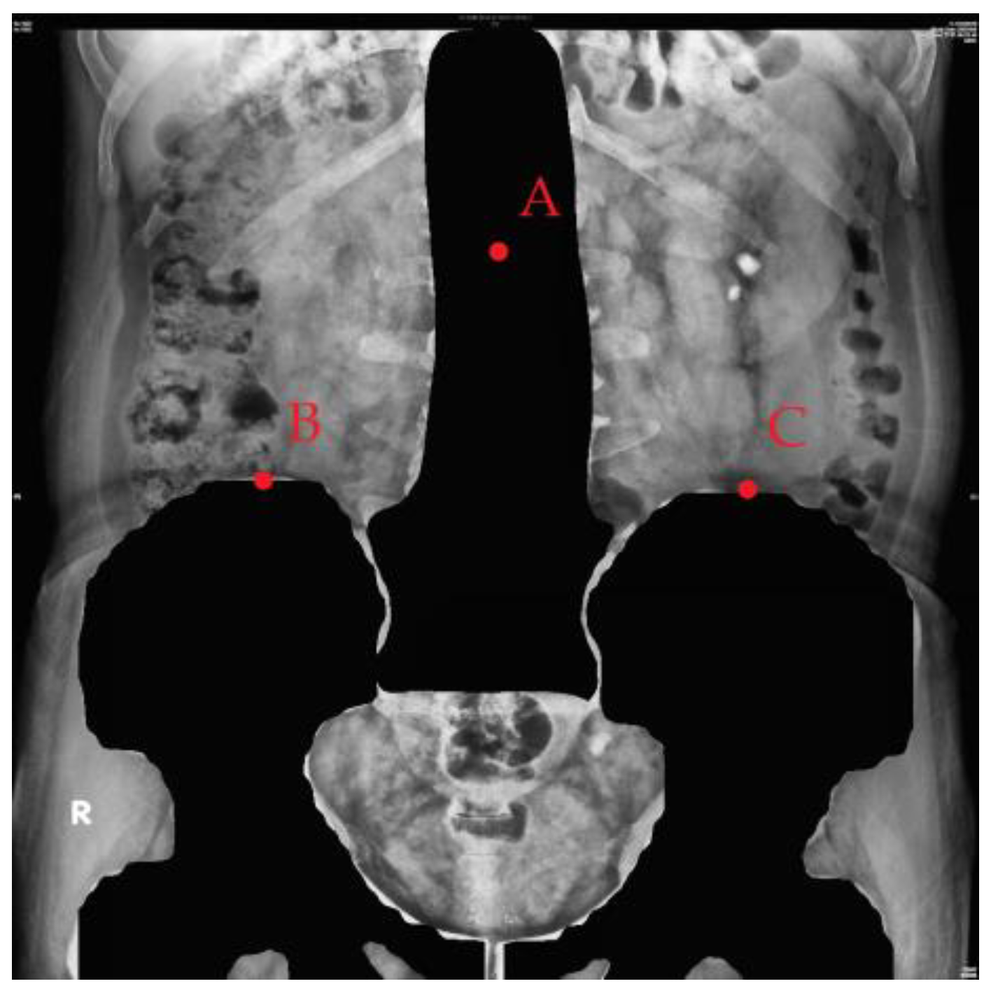 Bioengineering 10 00970 g009