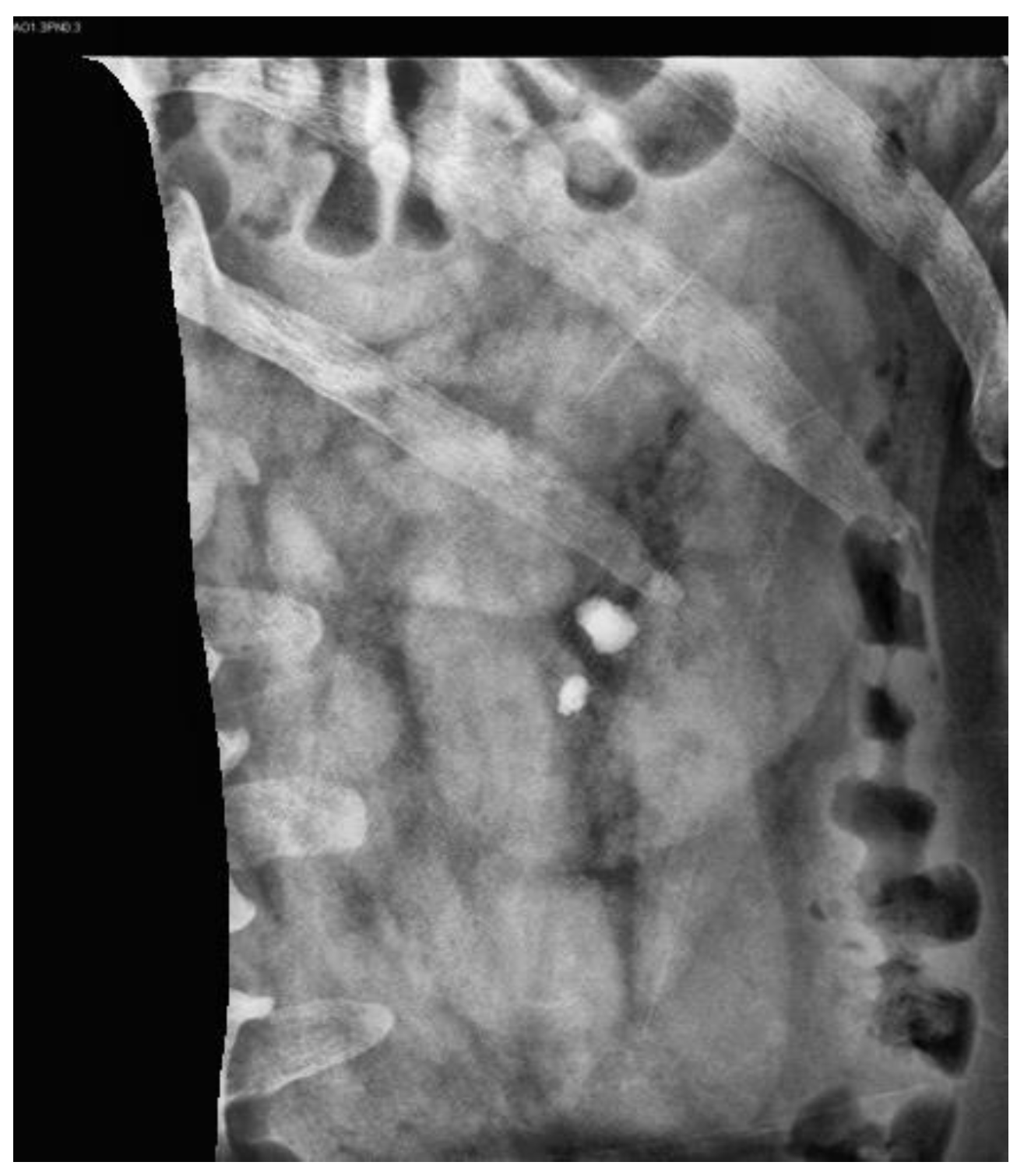 Bioengineering 10 00970 g011