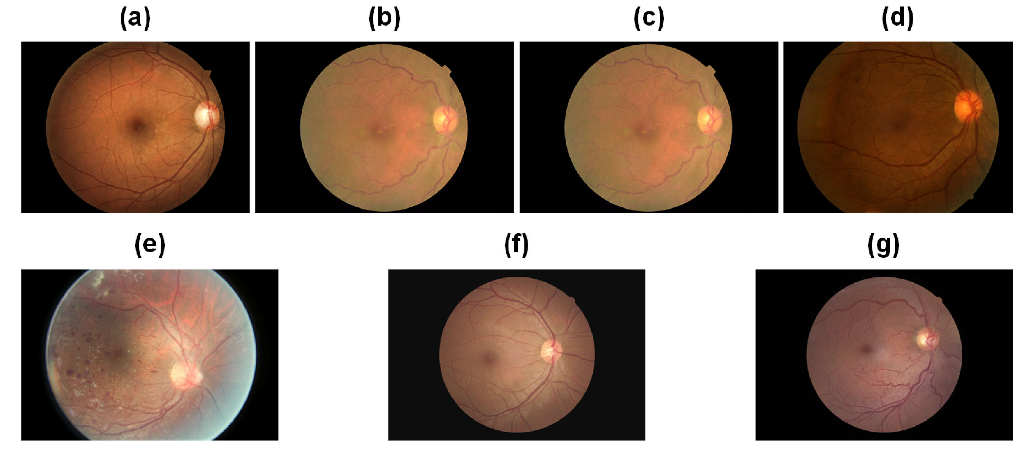 Bioengineering 10 00971 g006