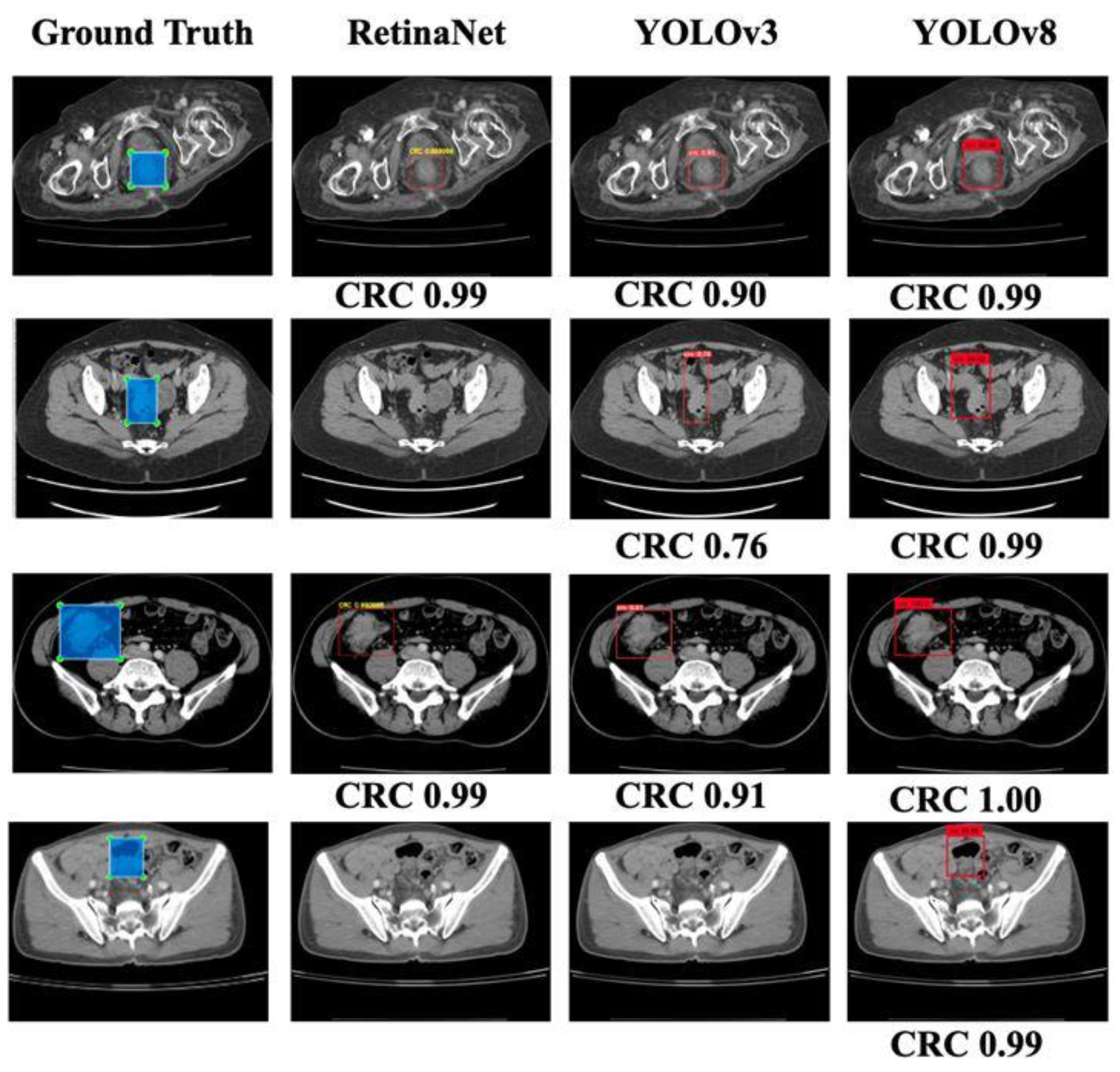 Bioengineering 10 00972 g005