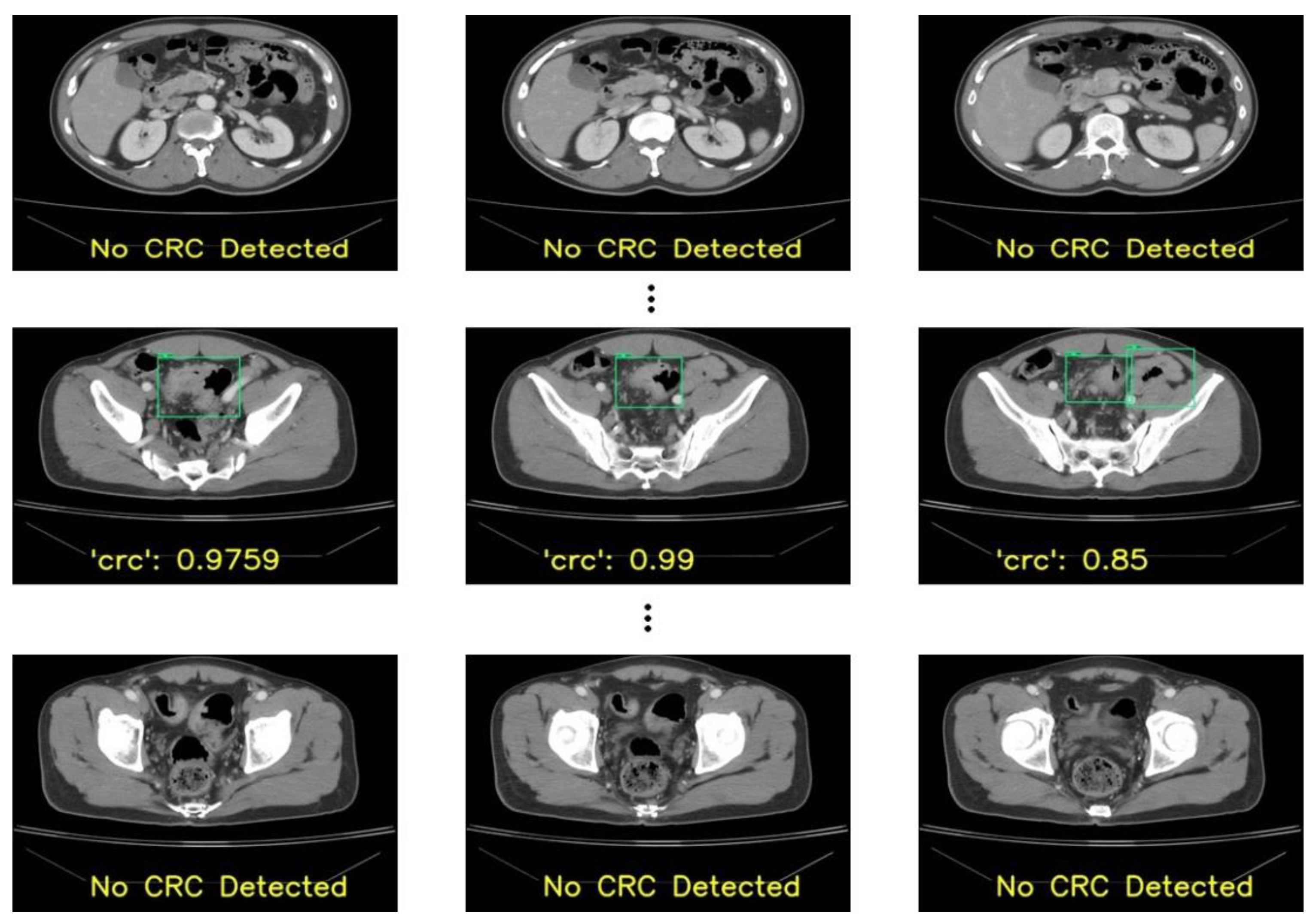 Bioengineering 10 00972 g007