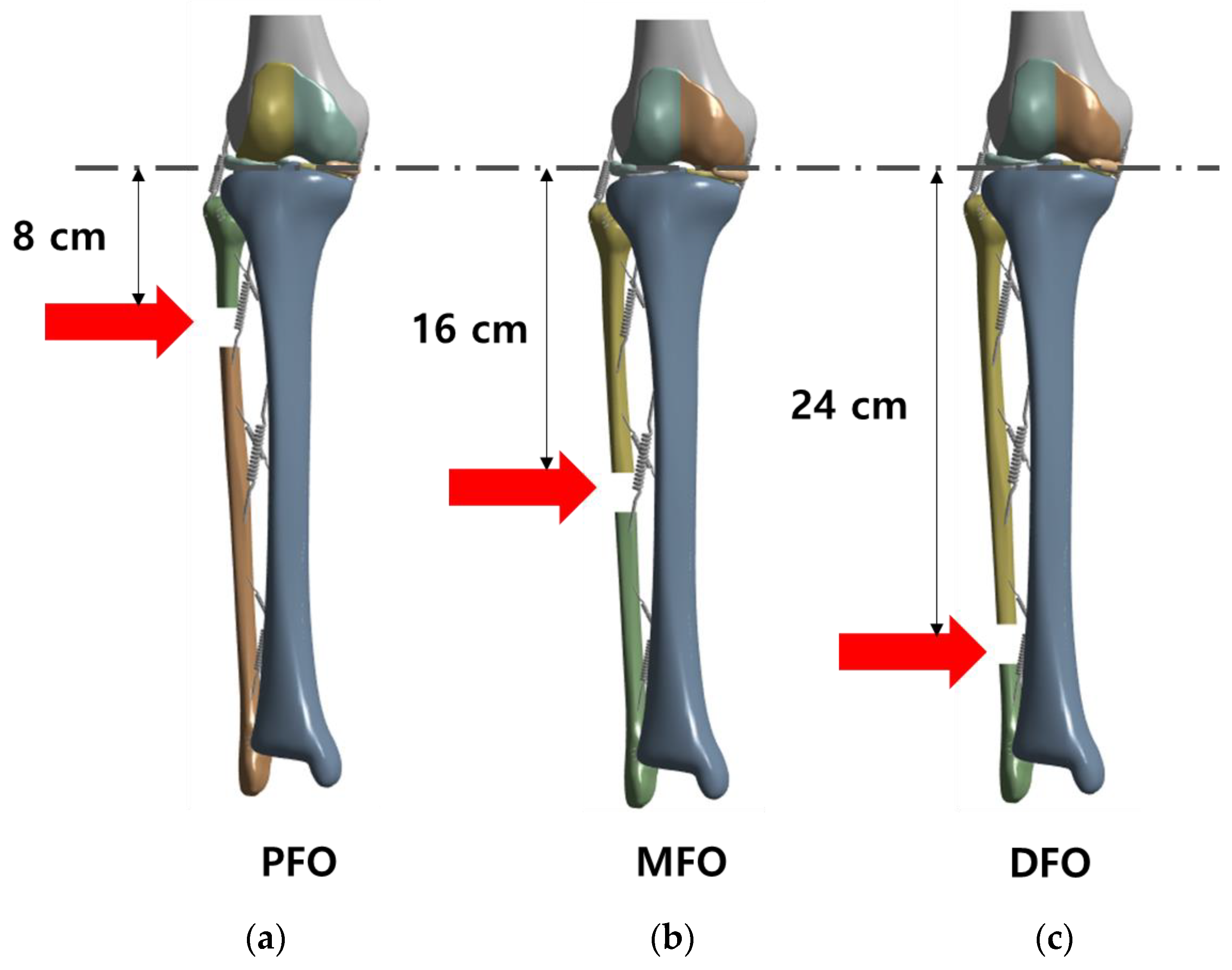 Bioengineering 10 01003 g003