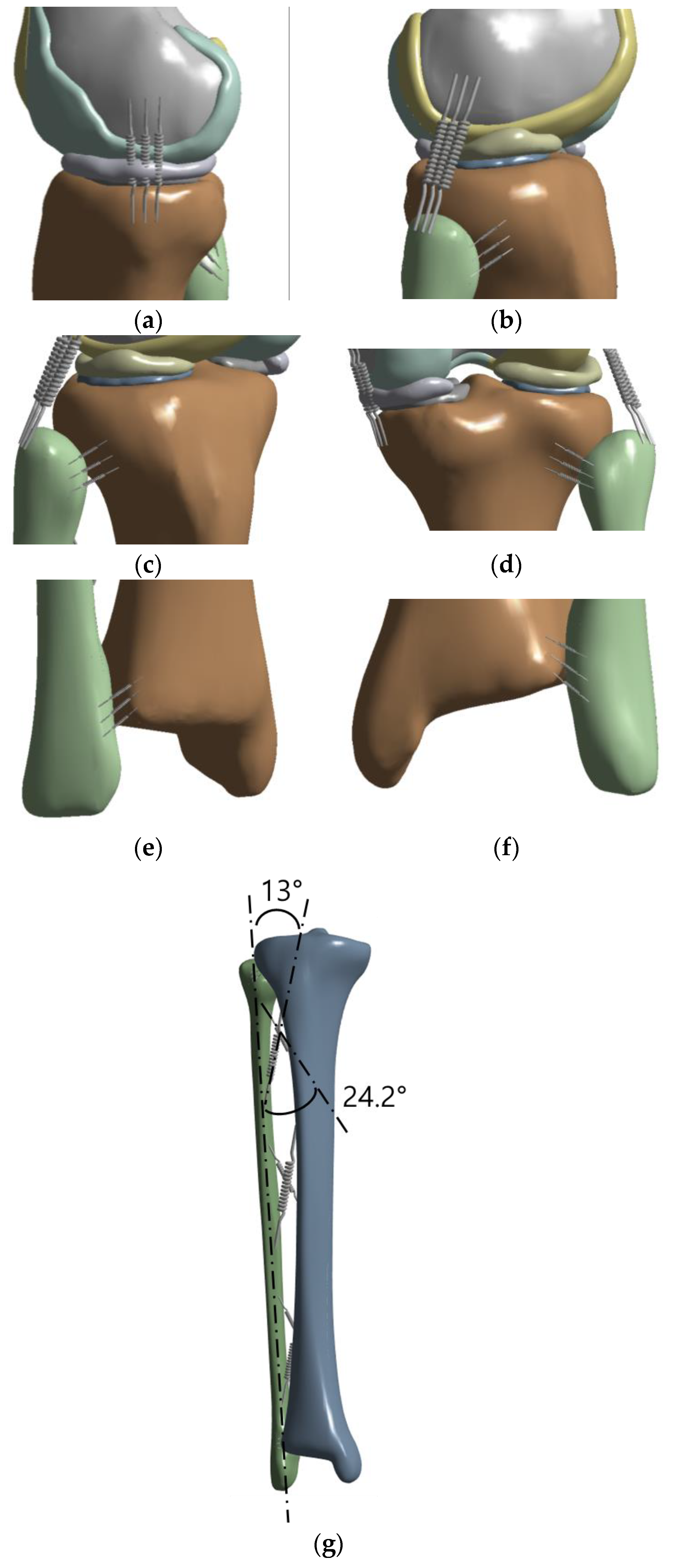 Bioengineering 10 01003 g004