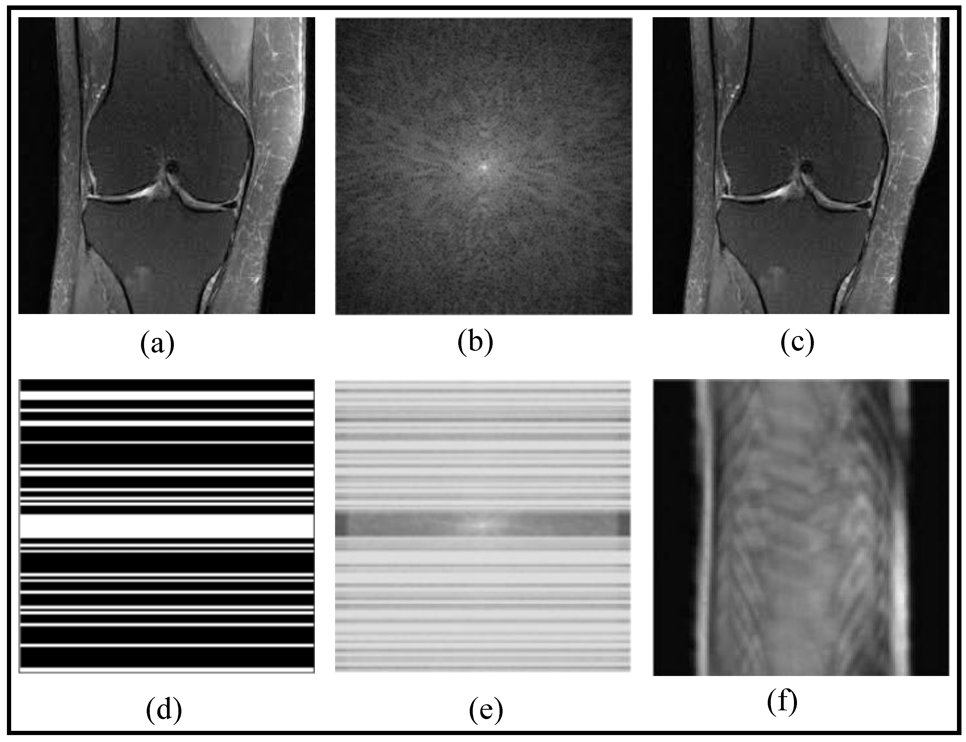 Bioengineering | Free Full-Text | Emerging Trends in Fast MRI Using ...