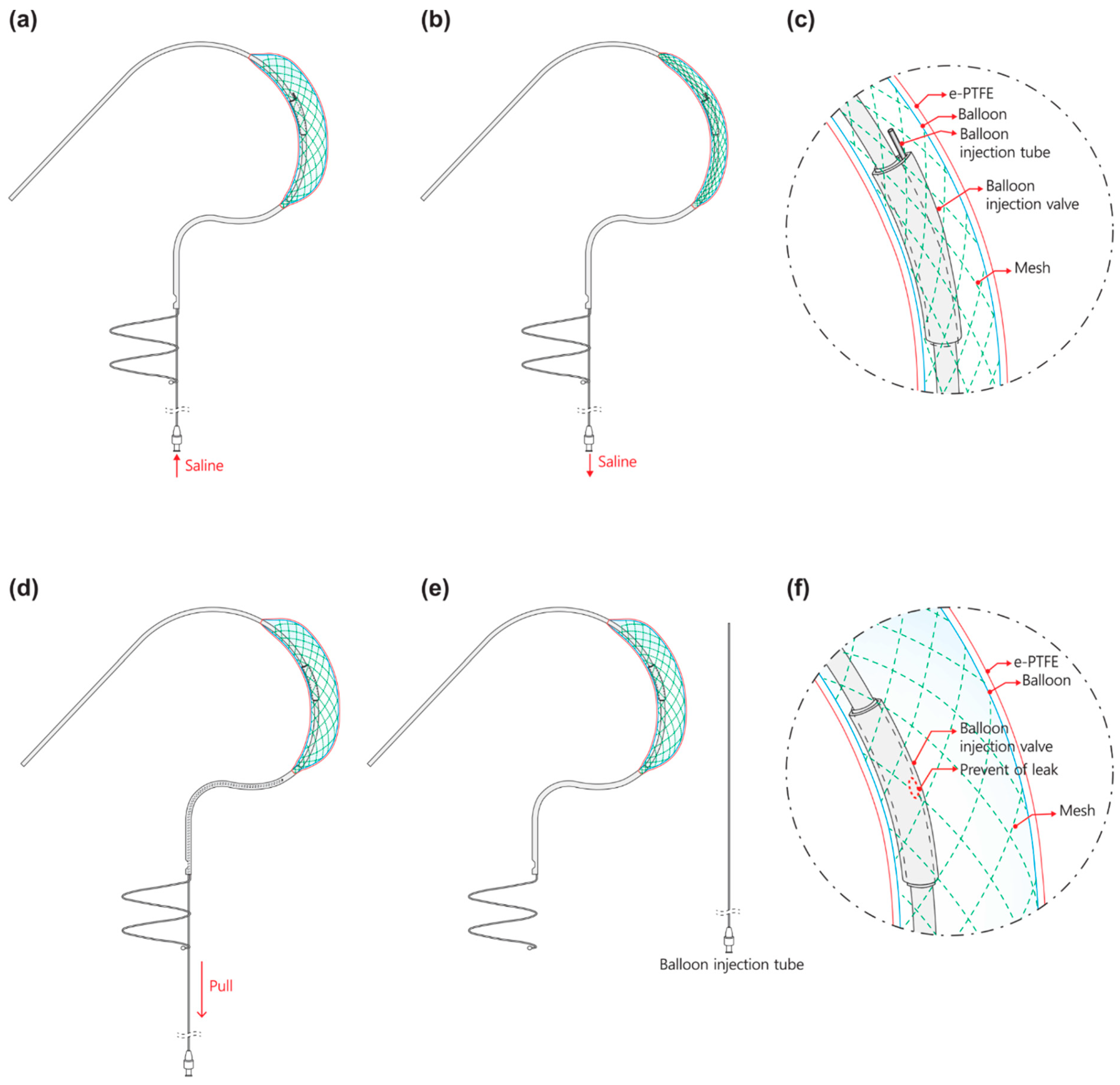 Bioengineering 10 01016 g002