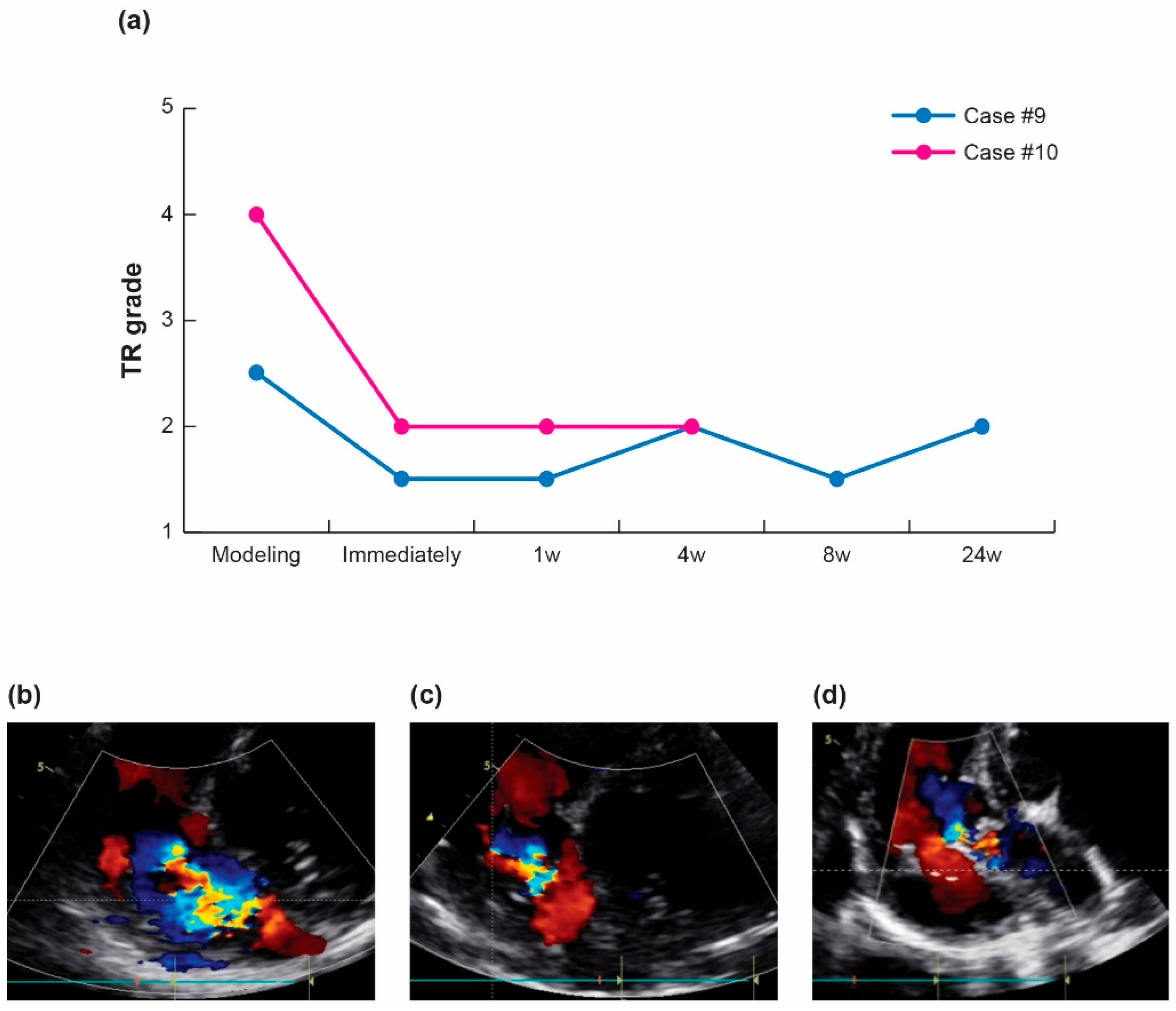 Bioengineering 10 01016 g004