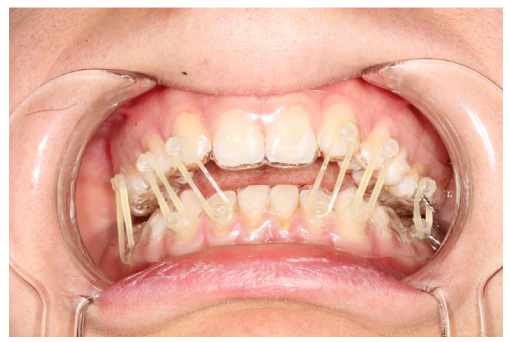 Bioengineering 10 01023 g002