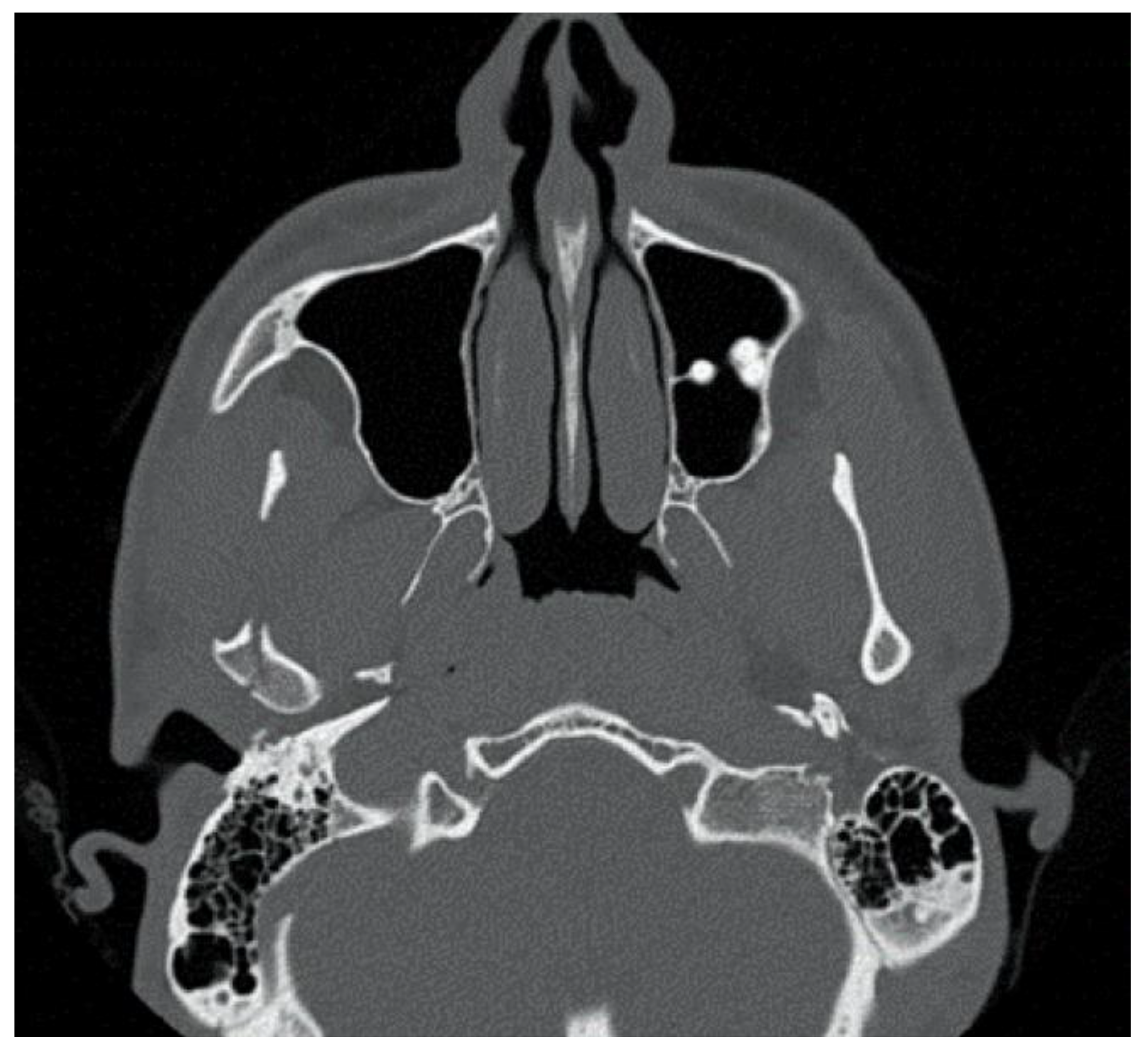 Bioengineering 10 01023 g004