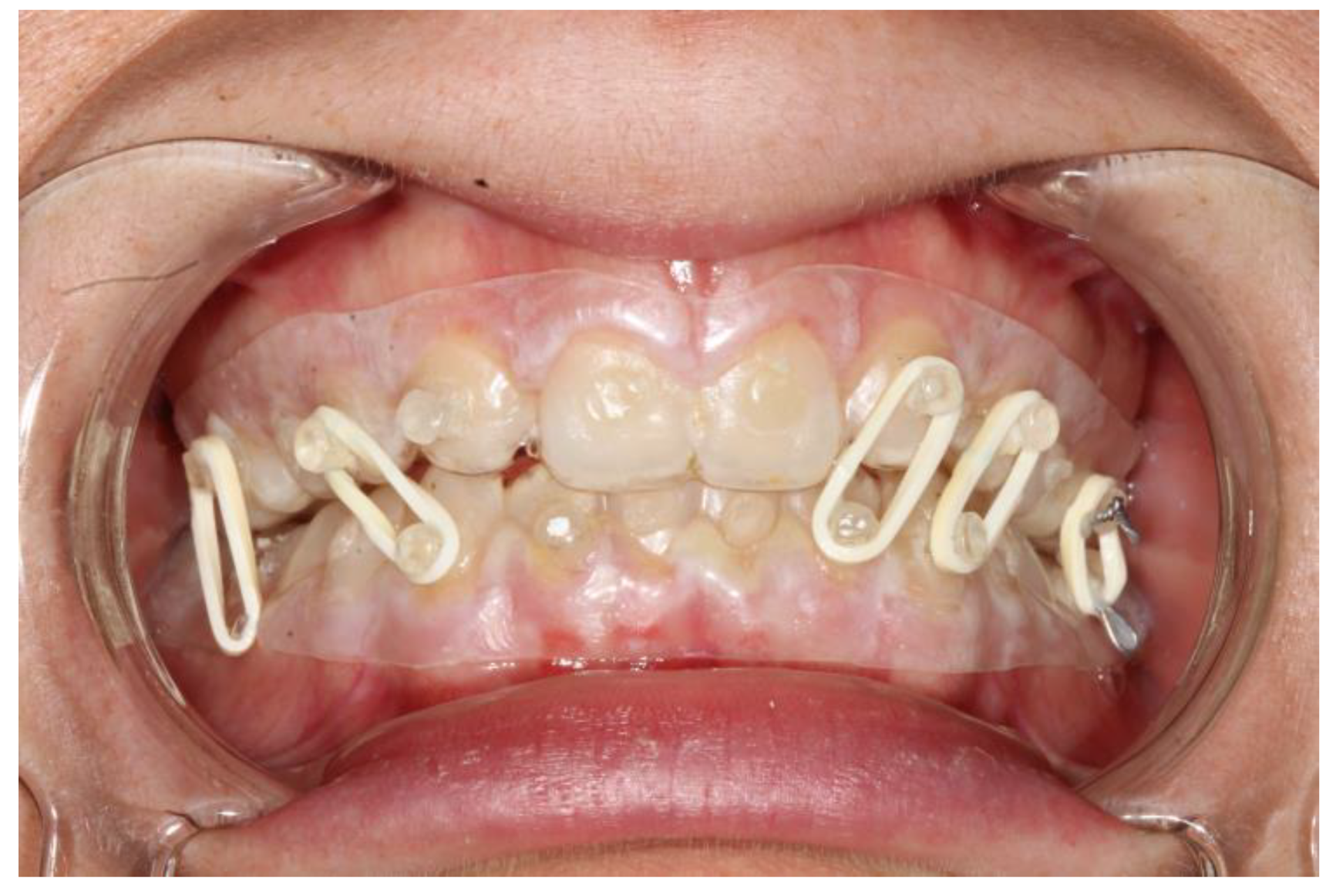 Bioengineering 10 01023 g006