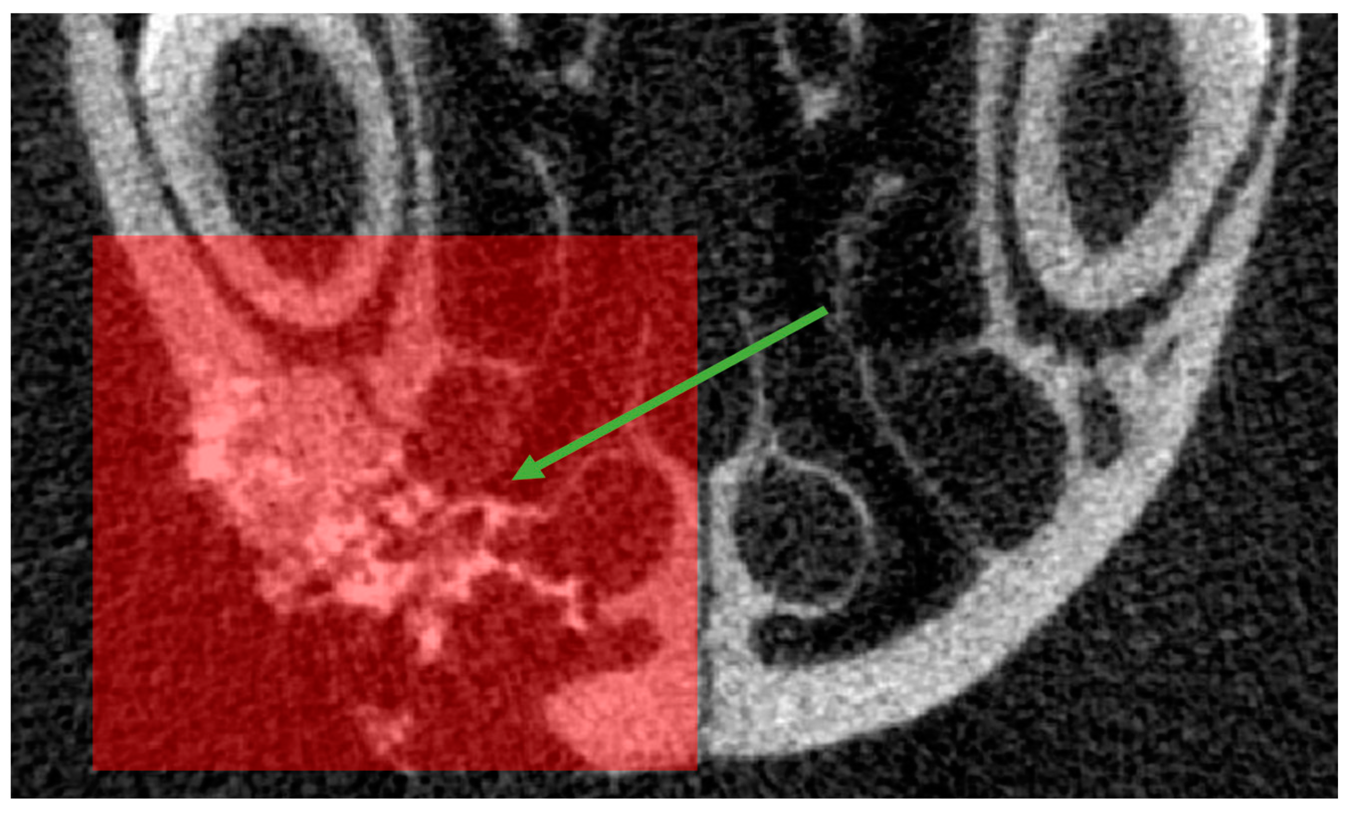 Bioengineering 10 01035 g006