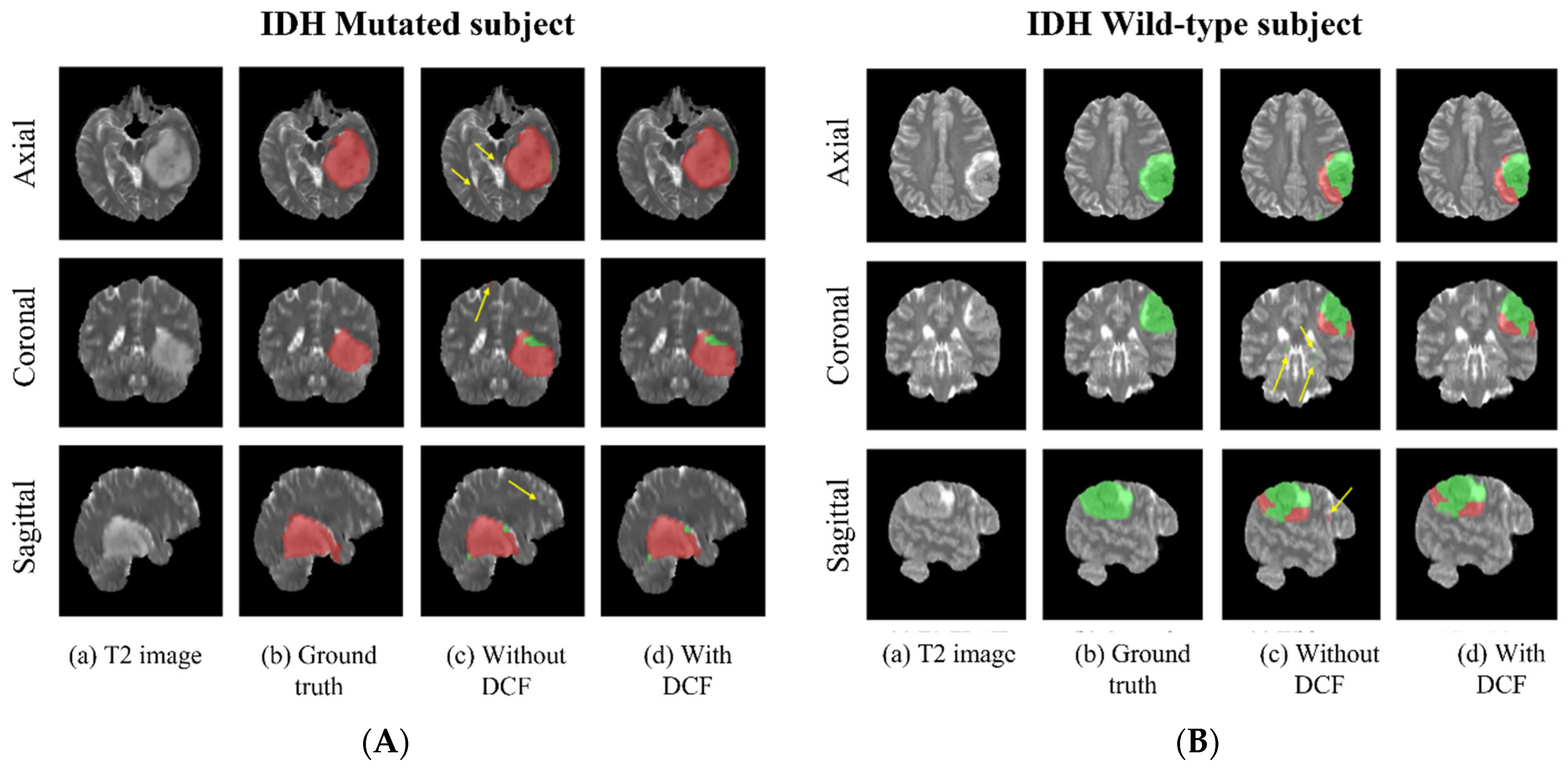 Bioengineering 10 01045 g004 Bioengineering 10 01045 g004