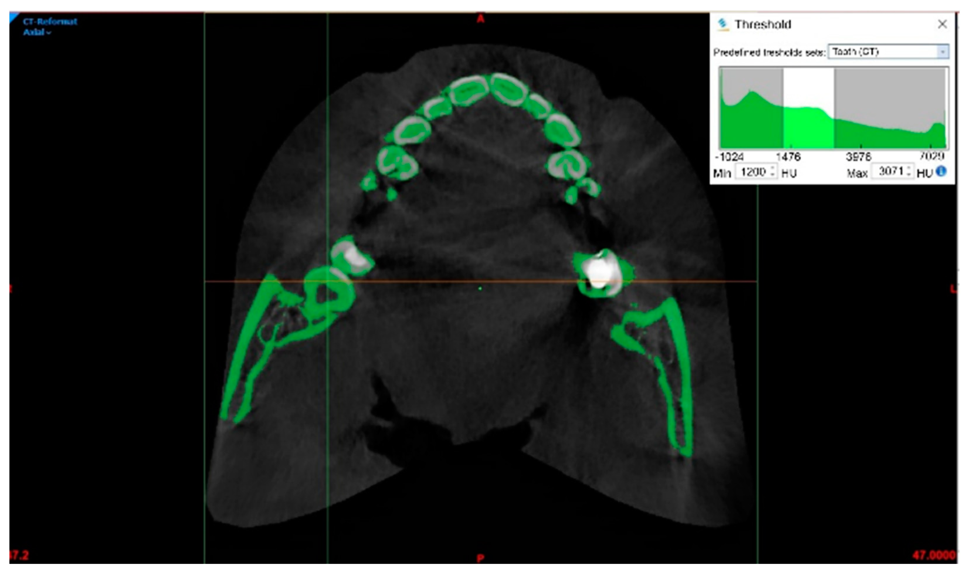Bioengineering 10 01058 g001