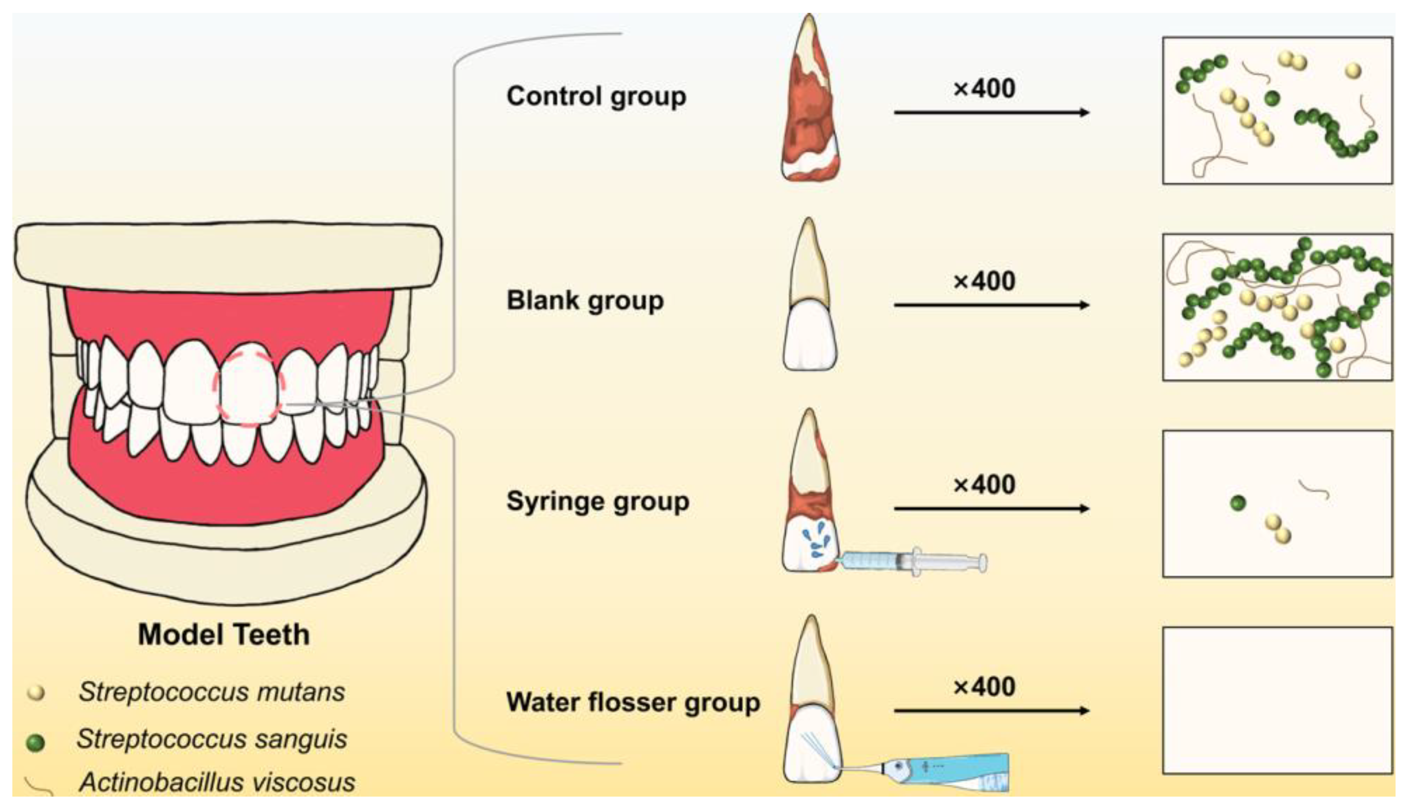 Efficient Removal of Dental Plaque Biofilm from Training Typodont 