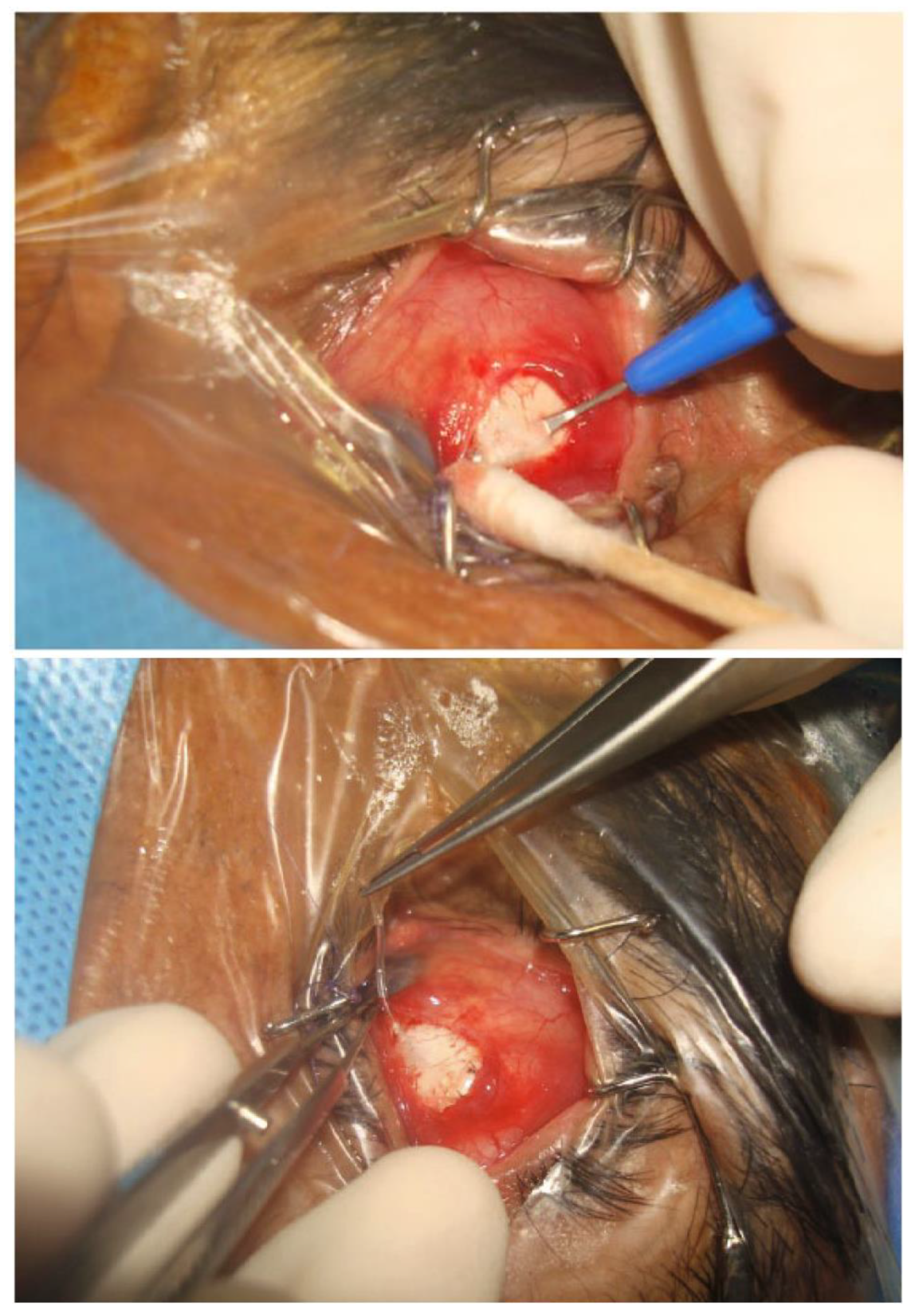 Bioengineering 10 01096 g003