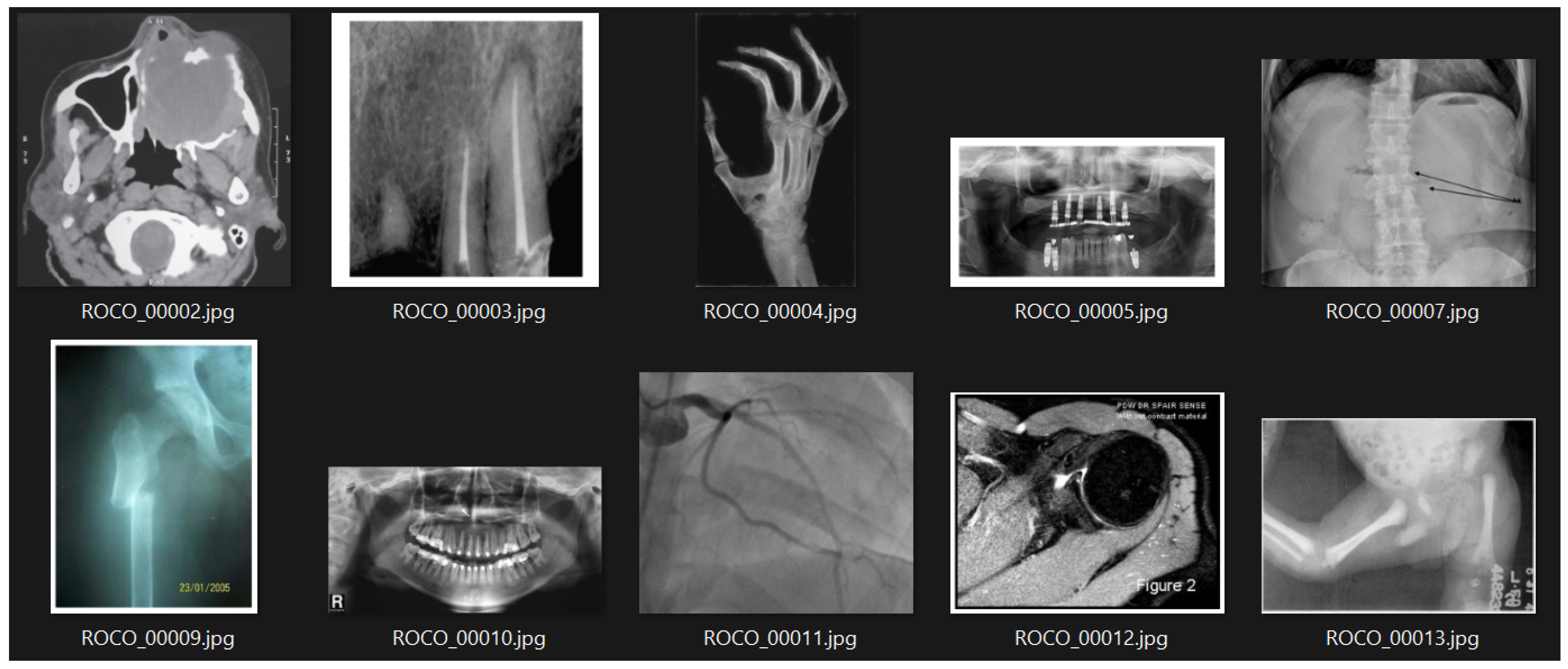 Bioengineering 10 01098 g001