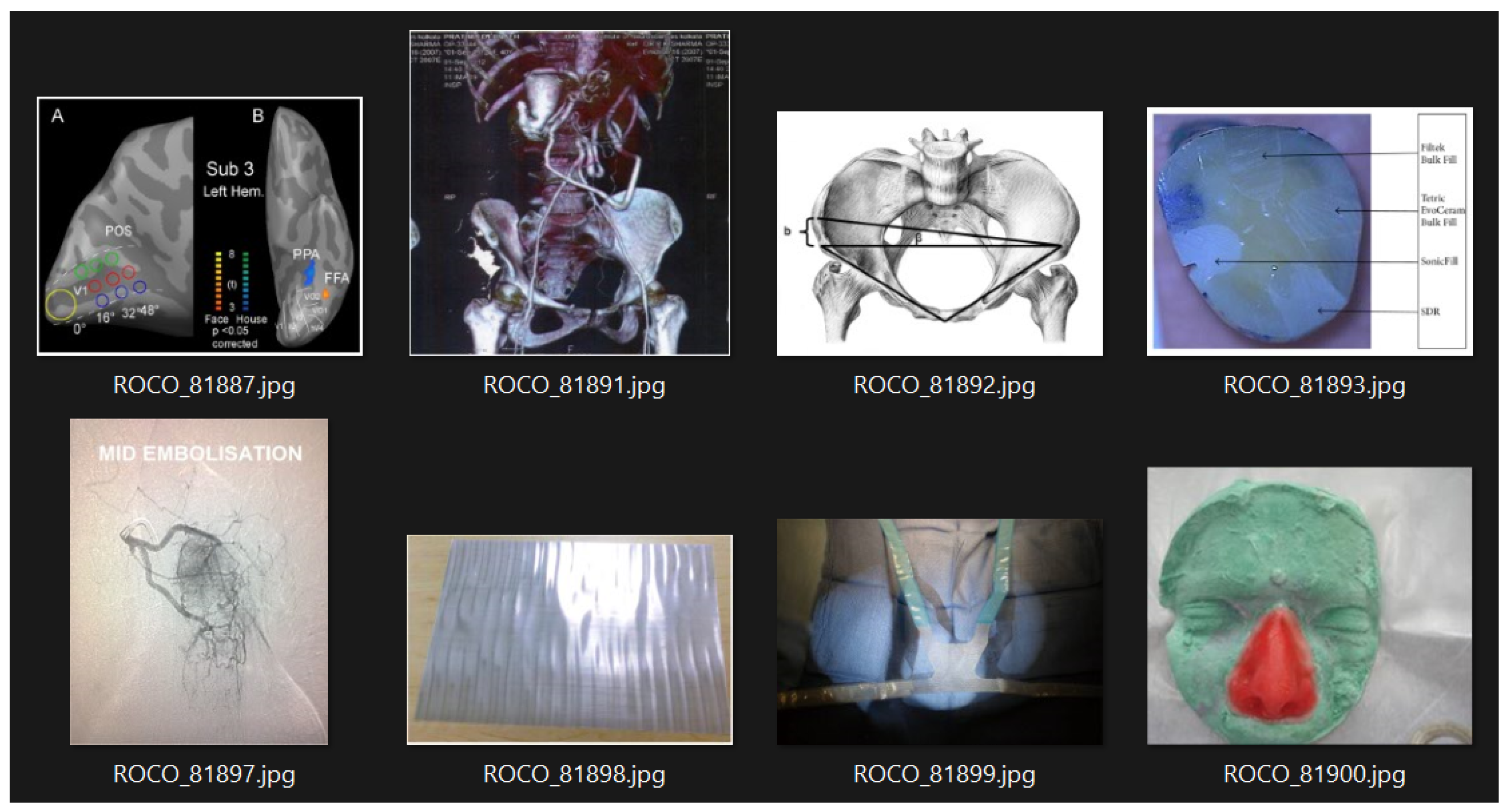 Bioengineering 10 01098 g002