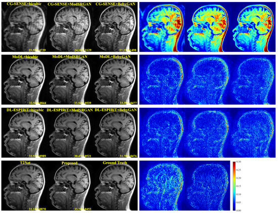 Joint Image Reconstruction and Super-Resolution for Accelerated ...