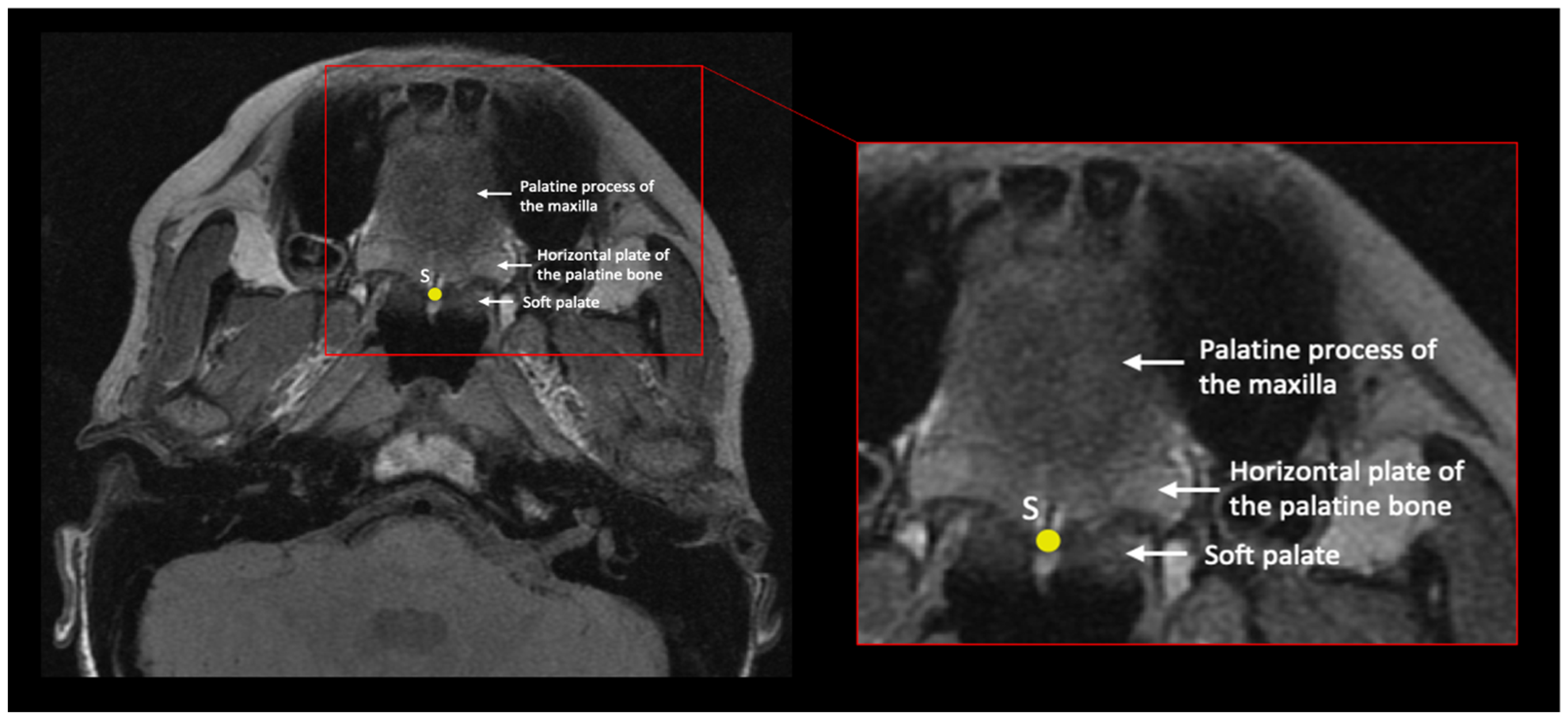 Bioengineering 10 01115 g005